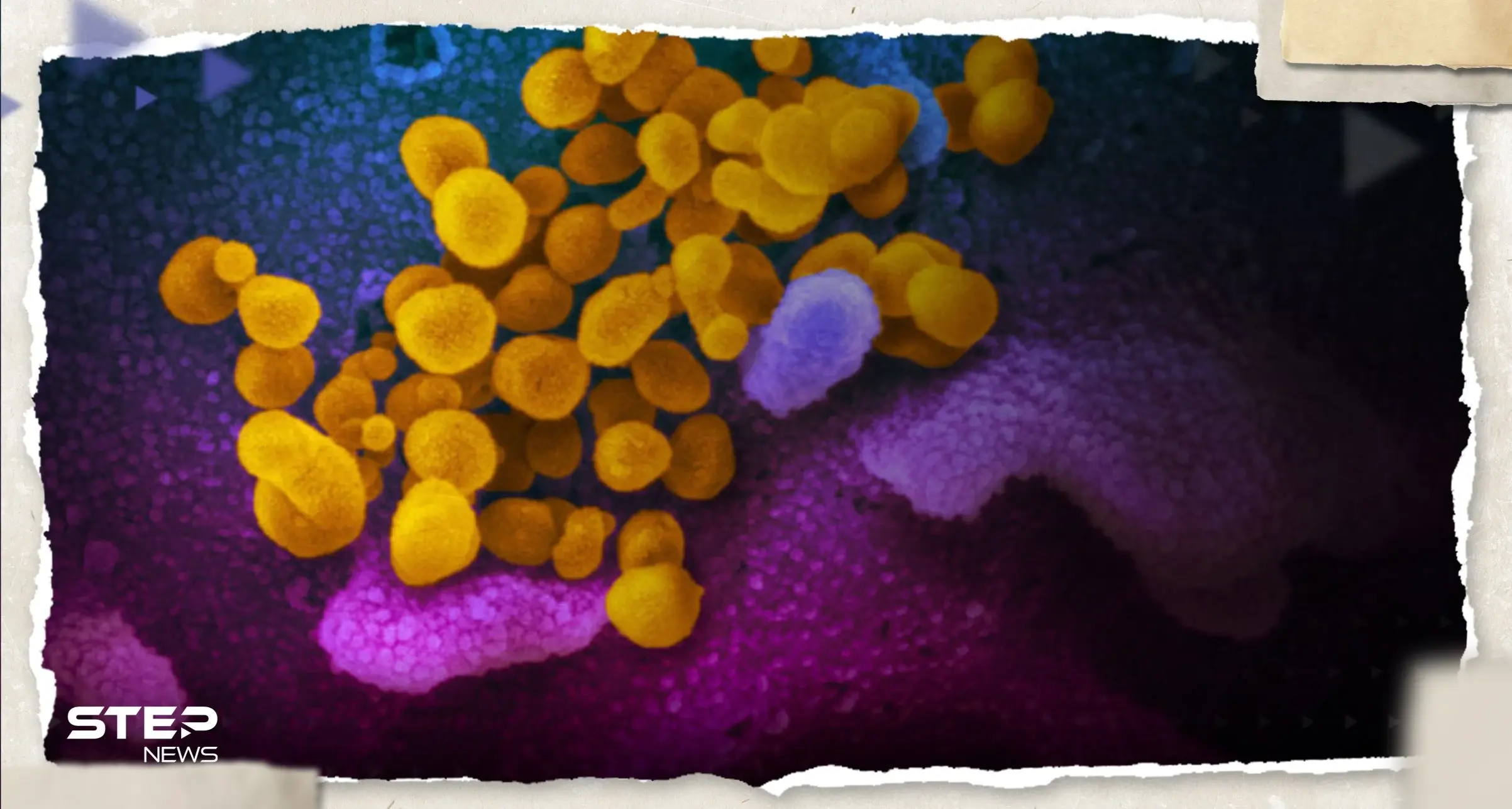 متحوّر جديد لفيروس كورونا.. "إيريس" ينتشر سريعاً في بريطانيا وأمريكا: فيروس كورونا