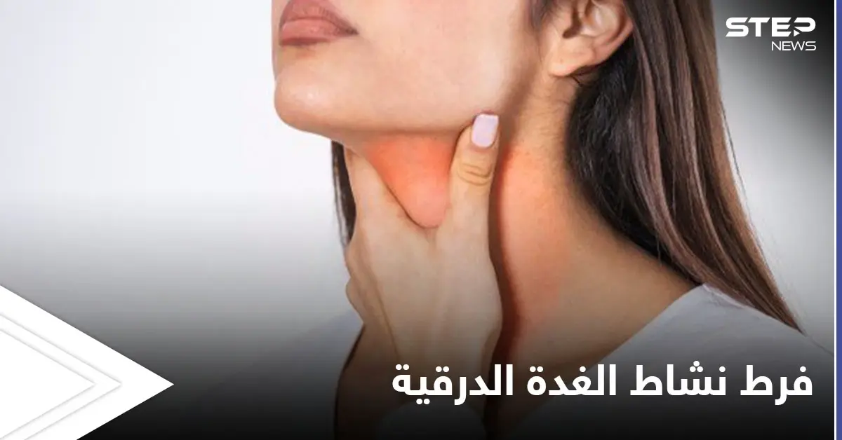 أهم الأعشاب لعلاج فرط نشاط الغدة الدرقية تعرف عليها: الغدة الدرقية