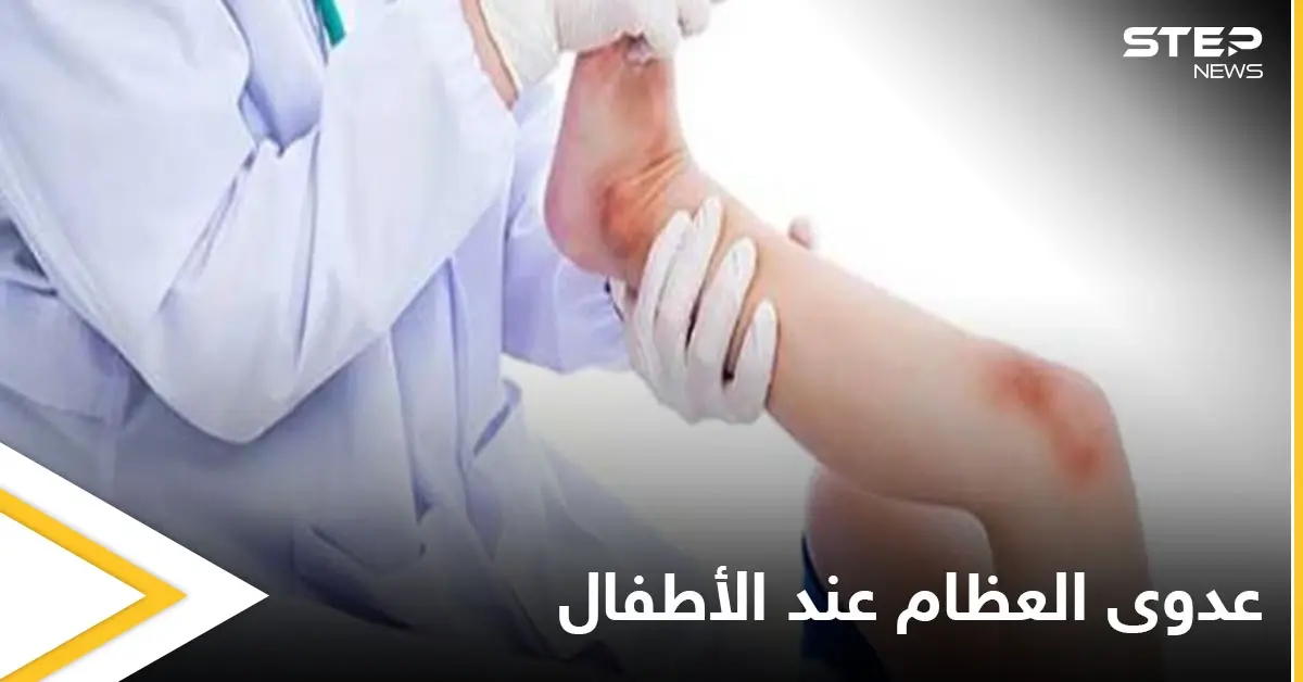 هل تصل الجراثيم إلى العظام وماهي عدوى العظام والمفاصل وخطورتها على الأطفال إليك أهم المعلومات: علاج