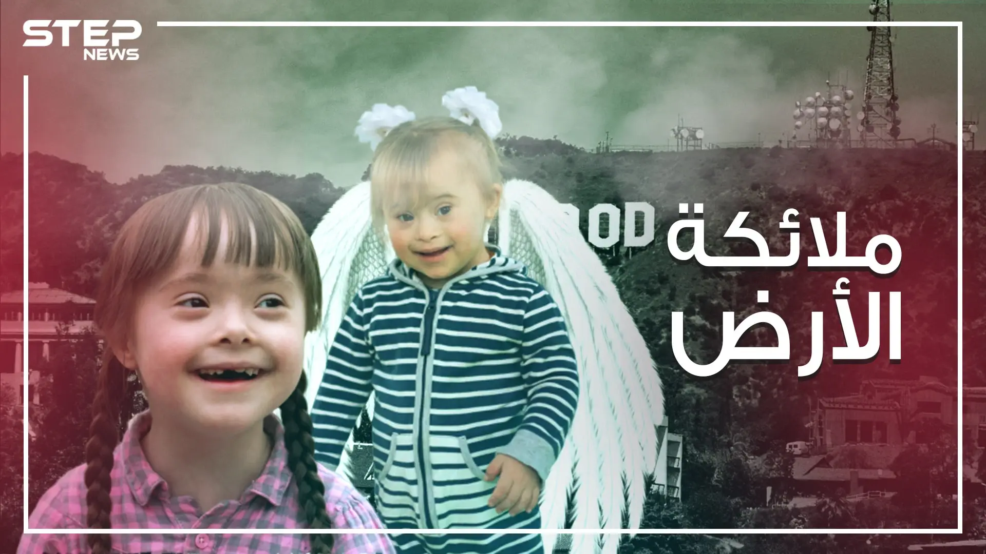 ليسوا منغوليين ..طفرة جينية نتج عنها هذا الشكل ..متلازمة داون الأسباب والتفاصيل: متلازمة داون