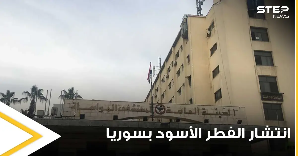 وسط ازدياد حالات الإصابة.. مدير إحدى المستشفيات السورية يكشف سبب زياة انتشار الفطر الأسود: الفطر الأسود