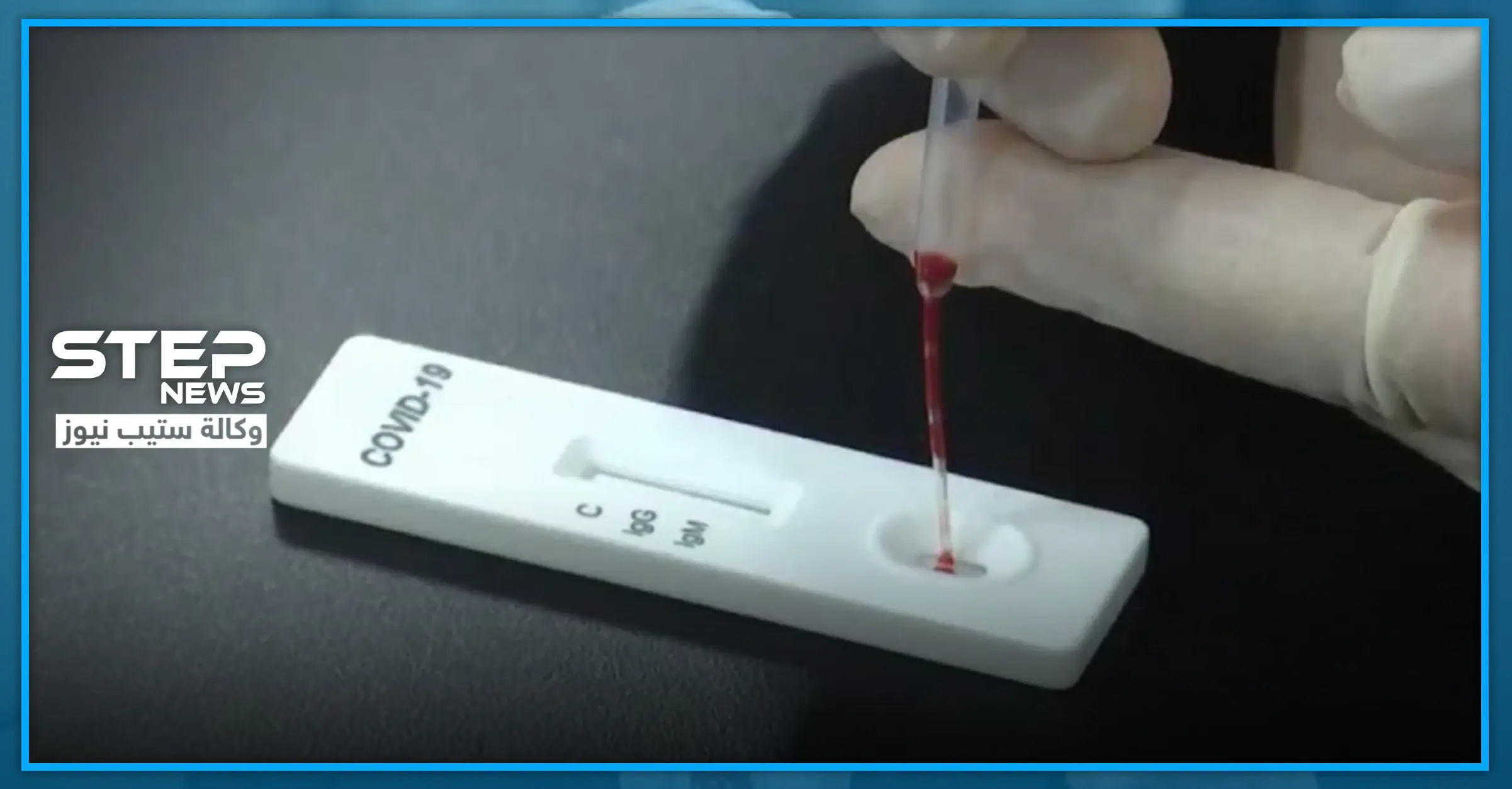 تركيا تطور أسرع وأدق جهاز منزلي للكشف عن "كورونا".. وتضع مقترحًا للقضاء عليه بـ 3 ثواني: إجراءات وقائية