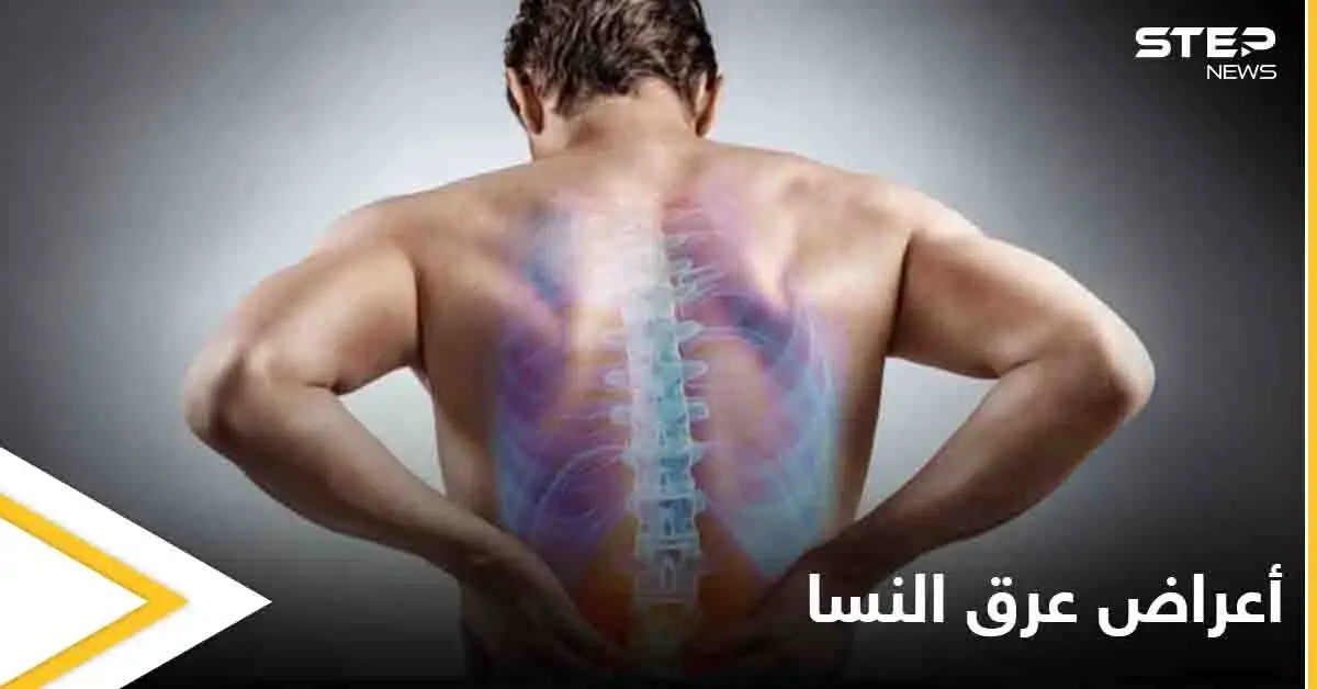 5 أعراض تخبرك بأنك مصاب بمرض عرق النسا تعرف عليها: عرق النسا