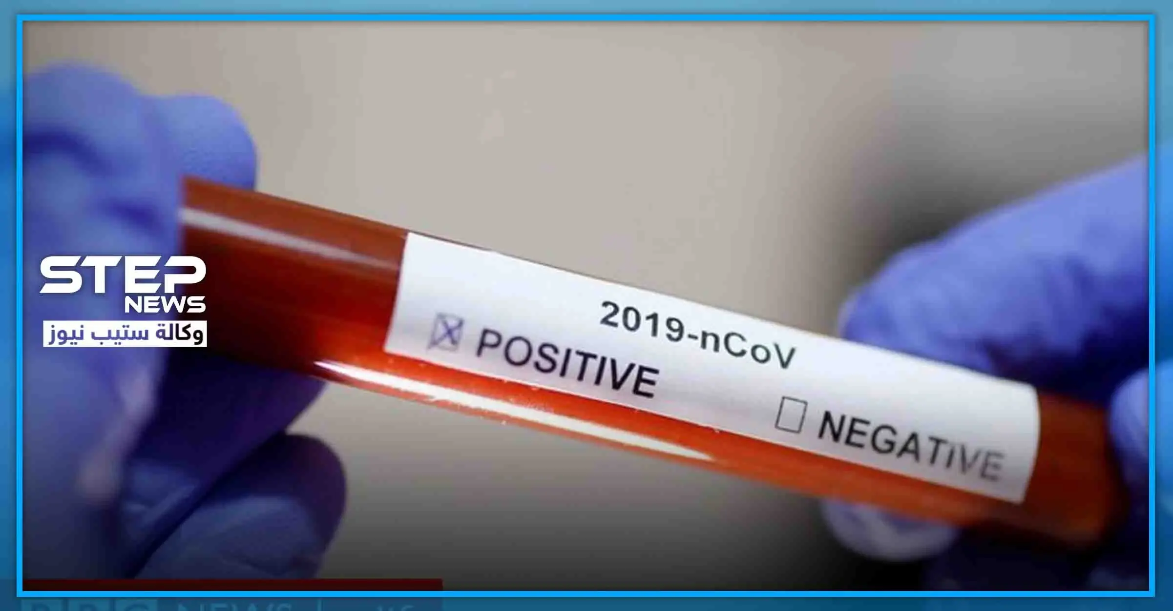 "الوراثة" لها الدور على قدرة تحمل الإنسان الإصابة بالكورونا ومقاومته للموت: الوراثة