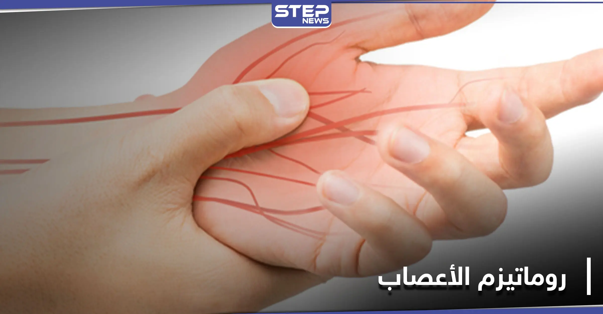 ما هو مرض روماتيزم الأعصاب.. أعراضه الــ"9" وطرق علاجه: فقر الدم