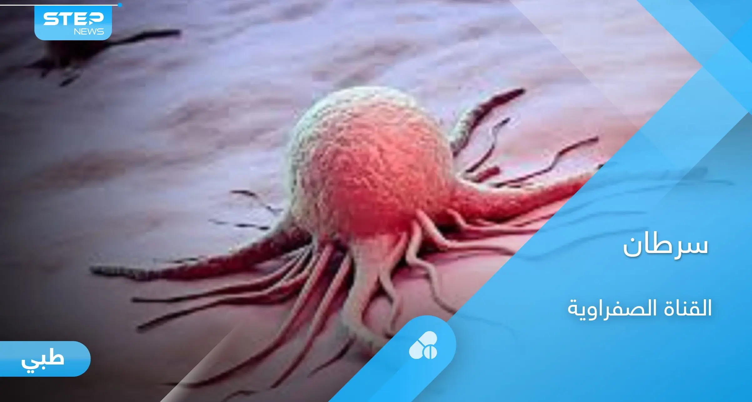 ما هو سرطان القناة الصفراوية وأعراضه الشائعة إليك أهم المعلومات: السرطان