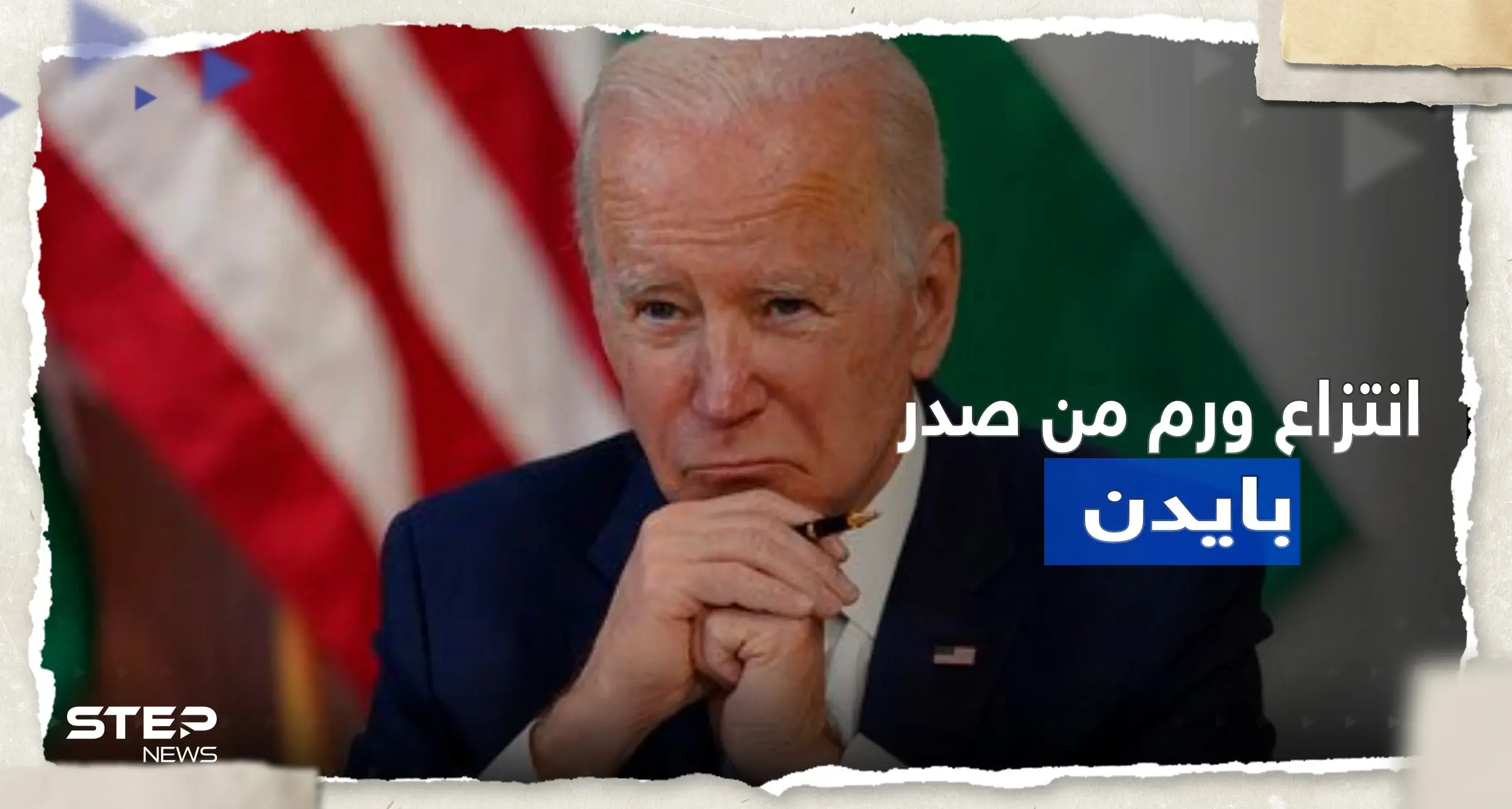 إزالة "ورم جلدي" من صدر بايدن وطبيبه يكشف 3 أمراض يعاني منها: مرض بايدن