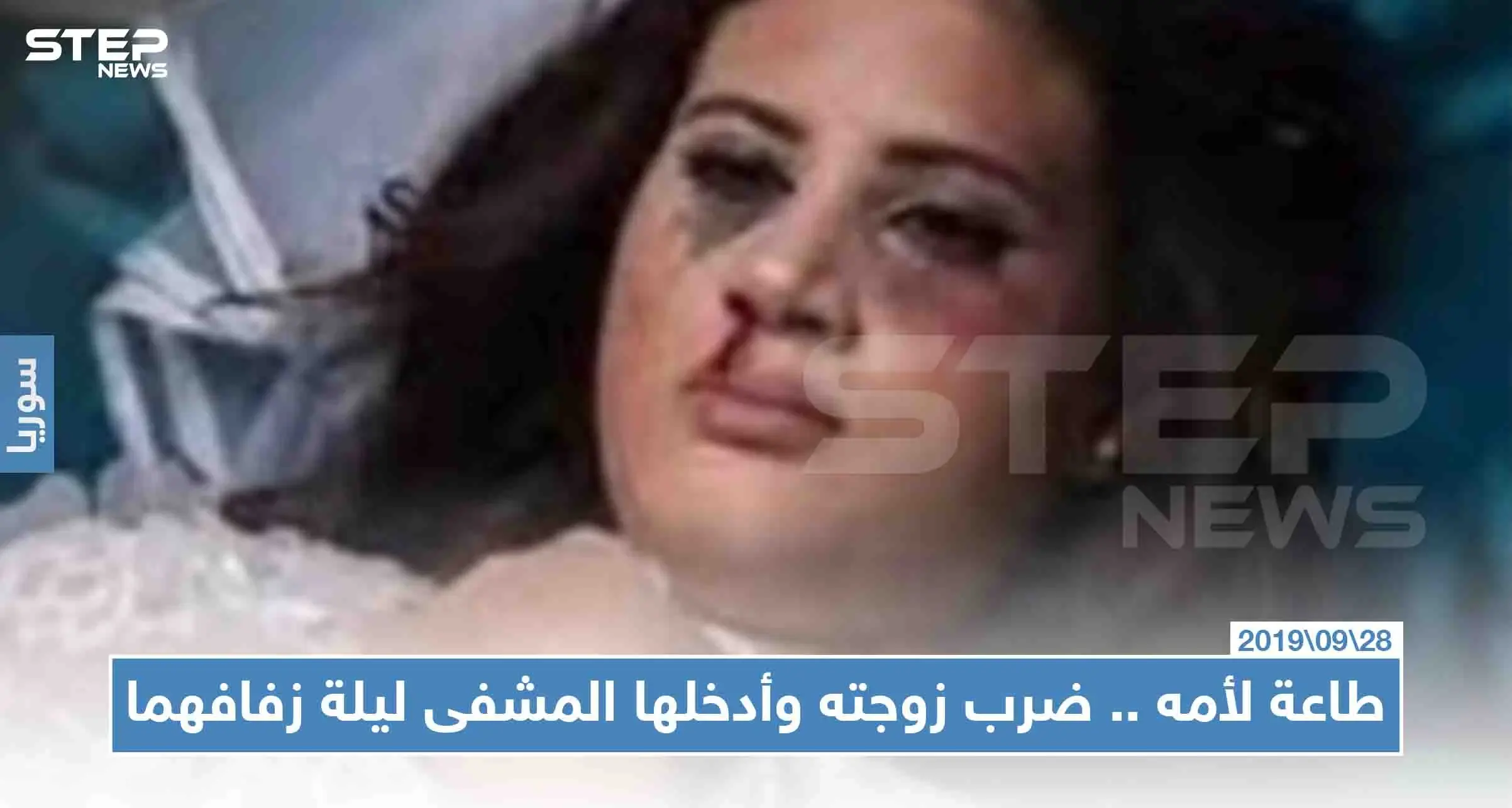 سمع كلام أمه وضرب زوجته ليلة زفافهما فأدخلها إلى العناية المركزة: الحسكة