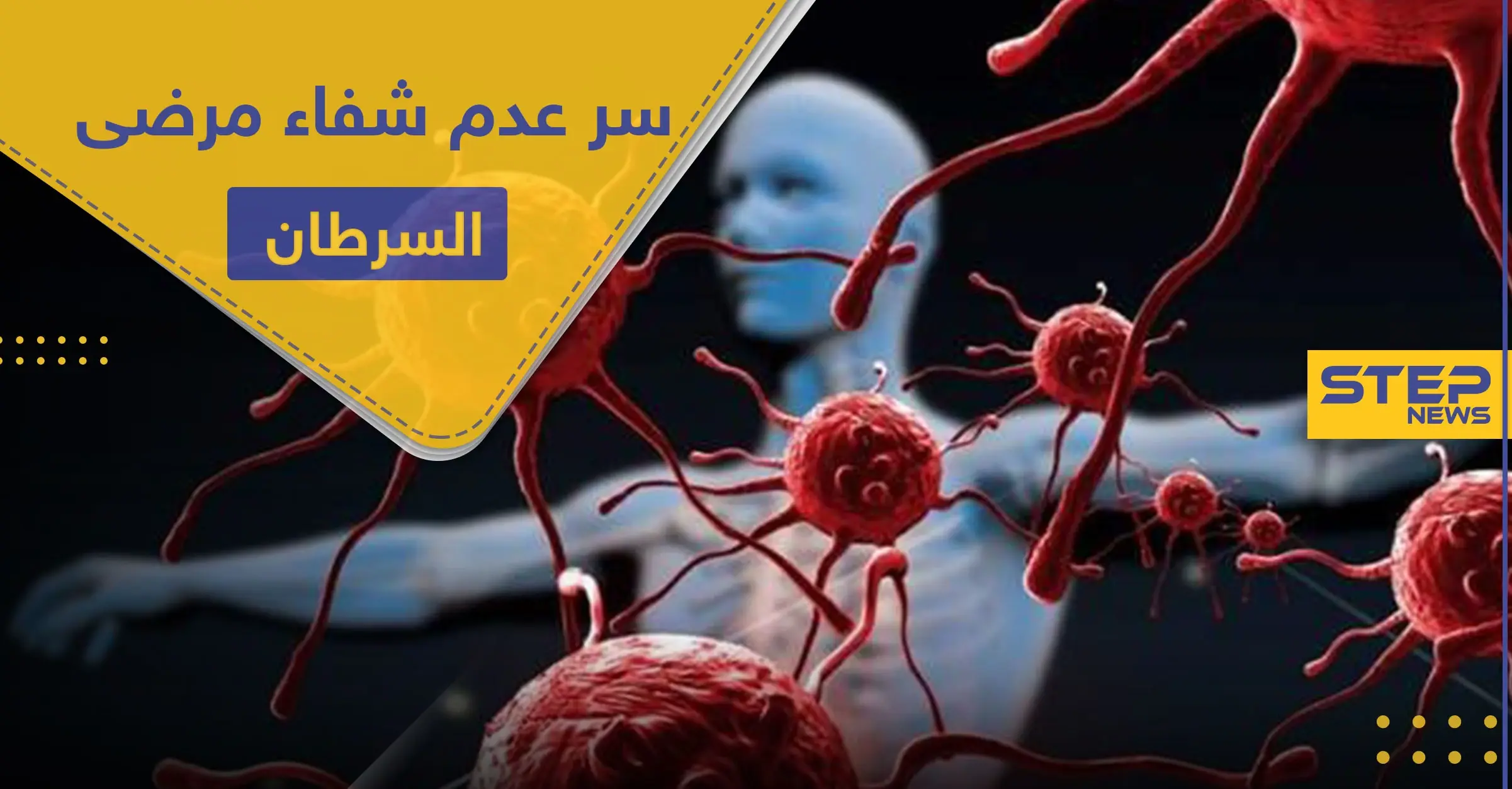 بحث أمريكي حديث.. يكشف خفايا مرض السرطان وسبب عدم امتثال المرضى للشفاء: السرطان