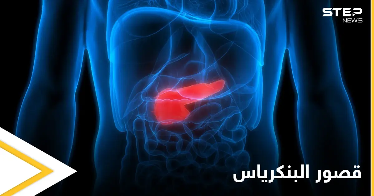 خطورة قصور البنكرياس وآثاره الصحية وطرق العلاج إليك أهم المعلومات: علاج