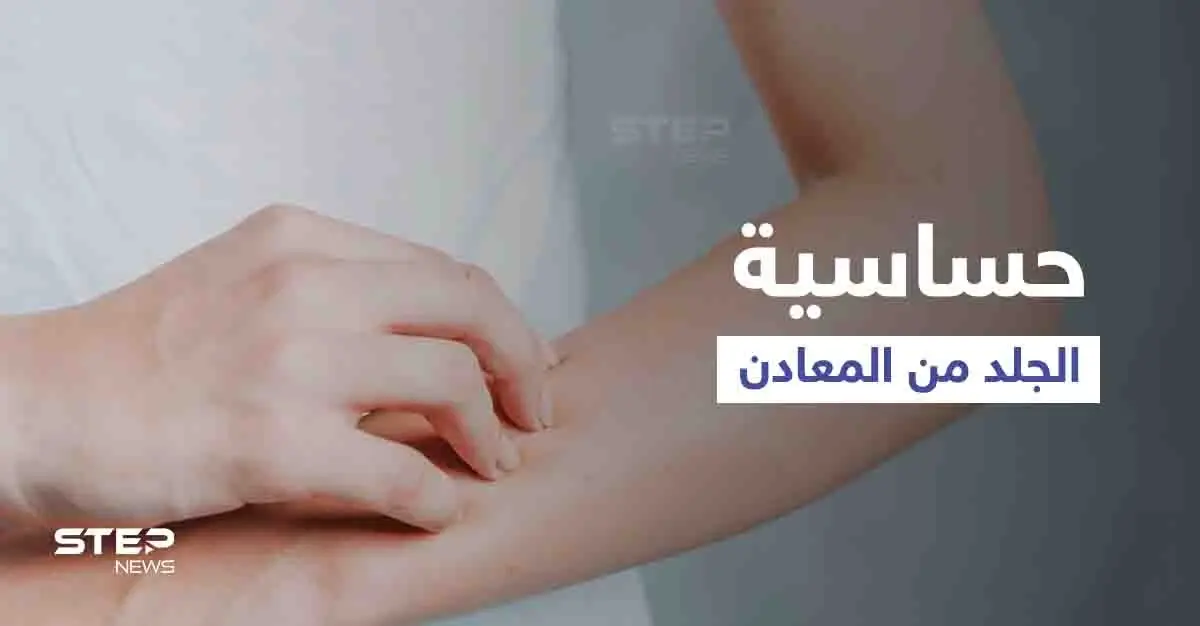 ما هي حساسية الجلد من المعادن وأهم أعراضها وطرق العلاج: علاج حساسية الجلد