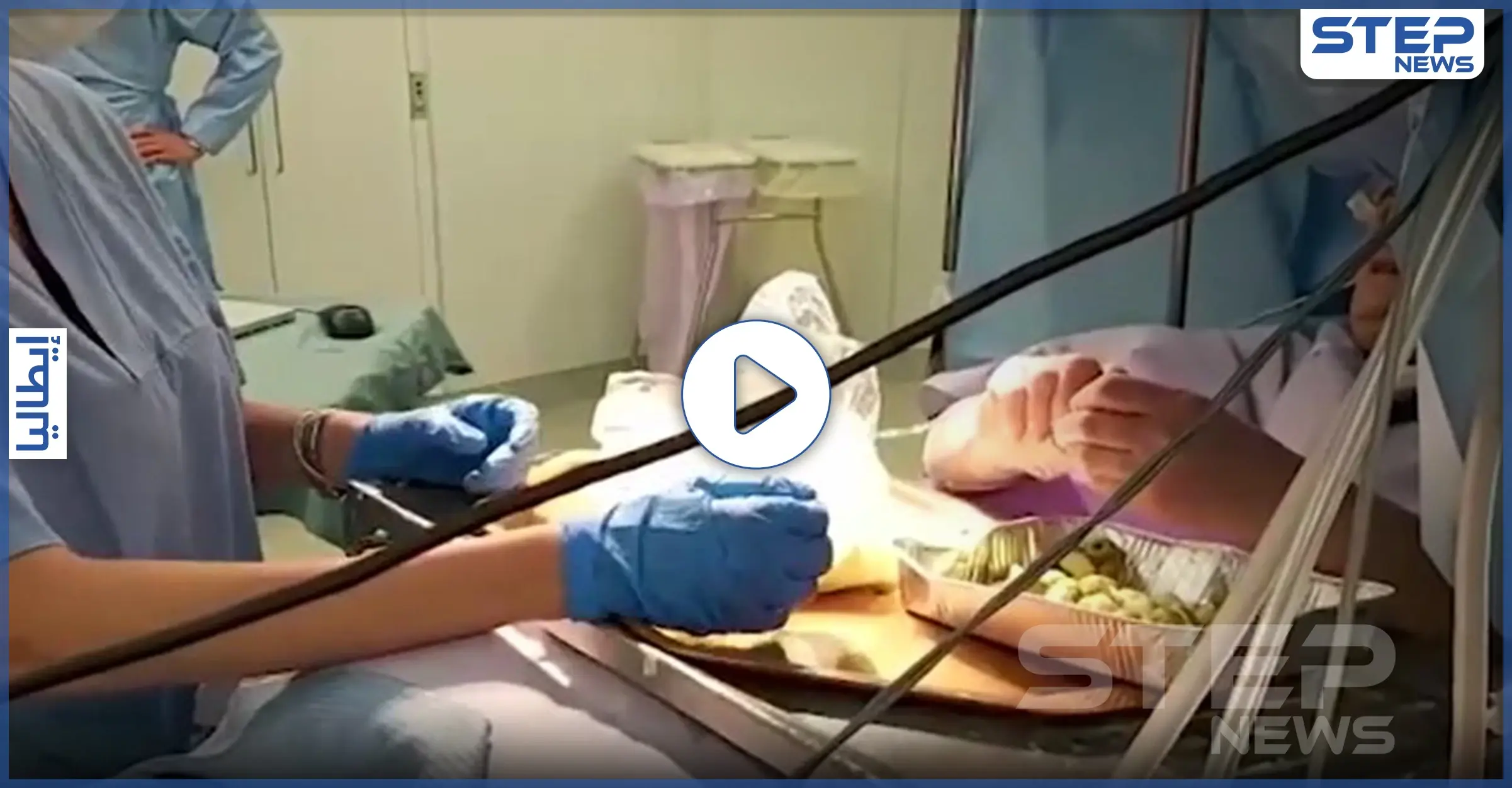 بالفيديو|| في حدث نادر لا يتكرر كثيراً.. سيدة تعد الطعام خلال خضوعها لعملية بالدماغ: سيدة
