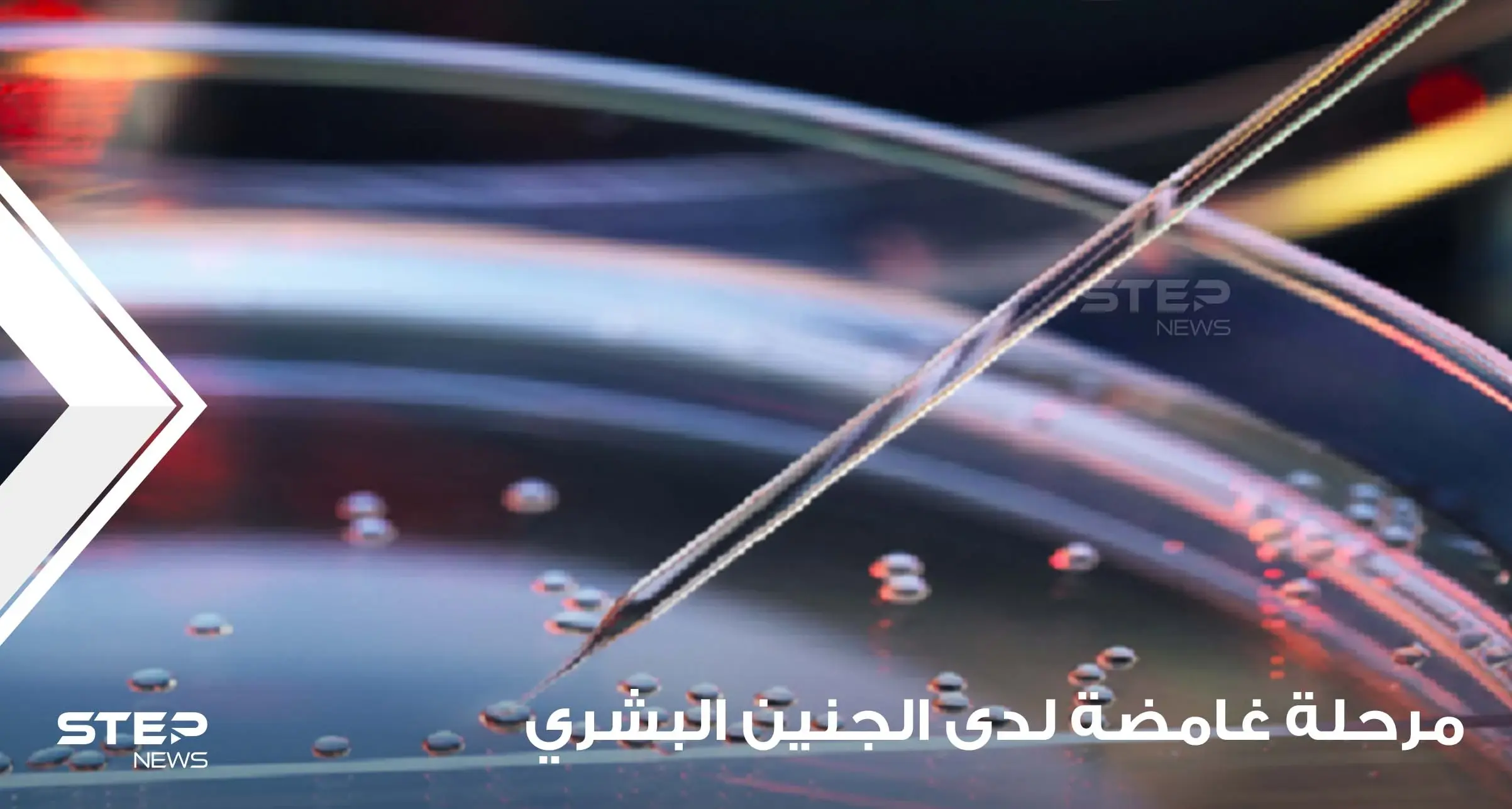 دراسة قد "تغير التاريخ".. علماء يكتشفون مرحلة "غامضة" لدى الجنين البشري ويوضحون التفاصيل: جنين بشري