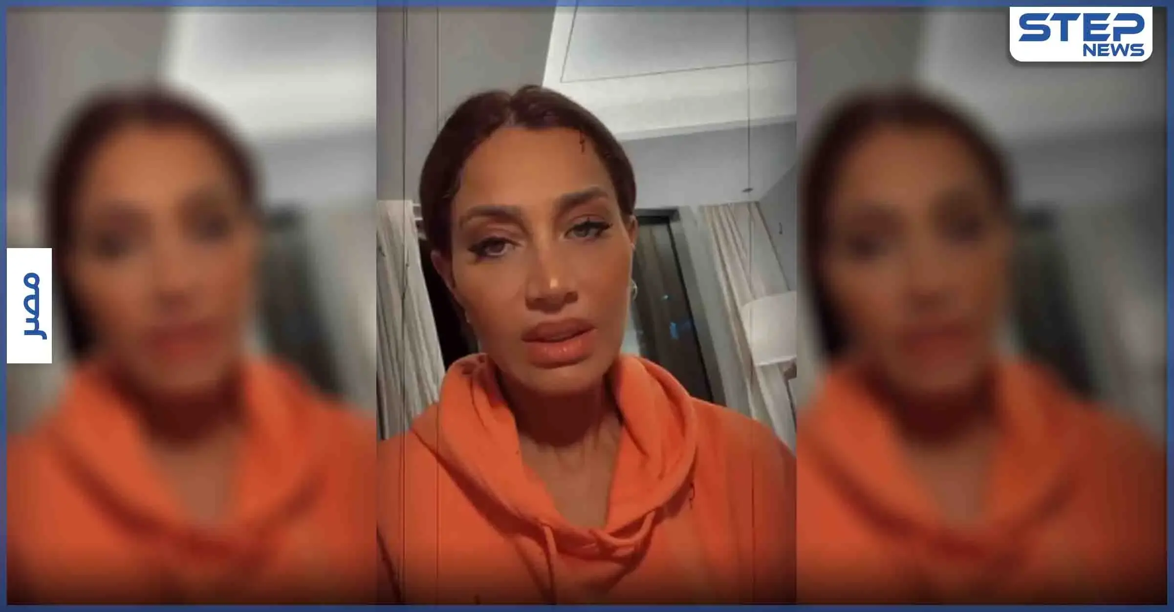 بالفيديو|| حقنة "بوتكس وفيلر" تسبب شلل عضلي بالوجه لــ إعلامية مصرية شهيرة: بسمة وهبة