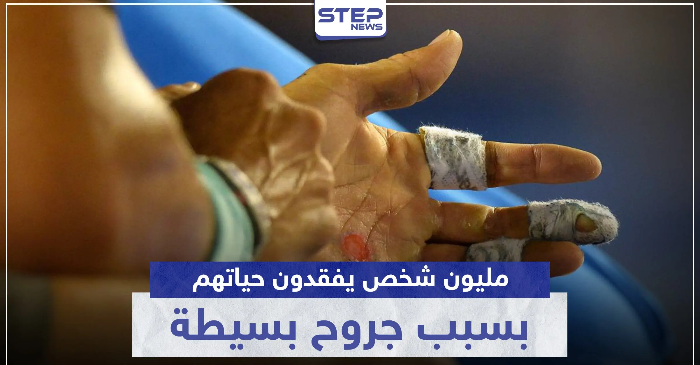 مليون شخص يفقدون حياتهم سنوياً بسبب جروح لا نعطيها أهمية.. تعرف ماذا تقول الدراسات: قناة