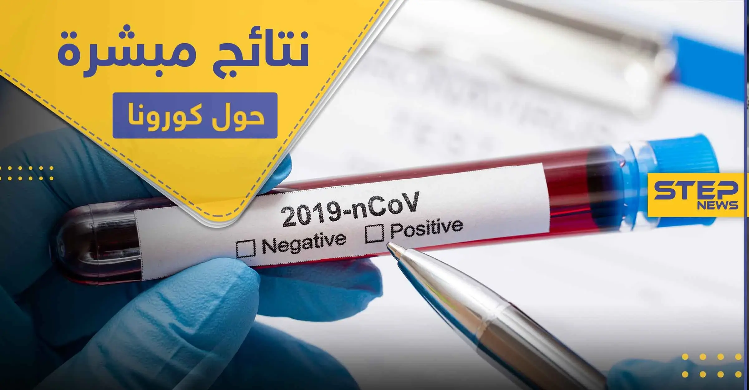 العلماء يتوصلون لنتيجة مبشرة حول كورونا .. والدواء: مختبر صيني