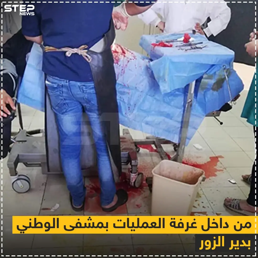 صورة متداولة من داخل غرفة العمليات بمشفى الوطني (النسائي) الملحق بمبنى مشفى الأسد الجامعي بدير الزور: خبر وصورة