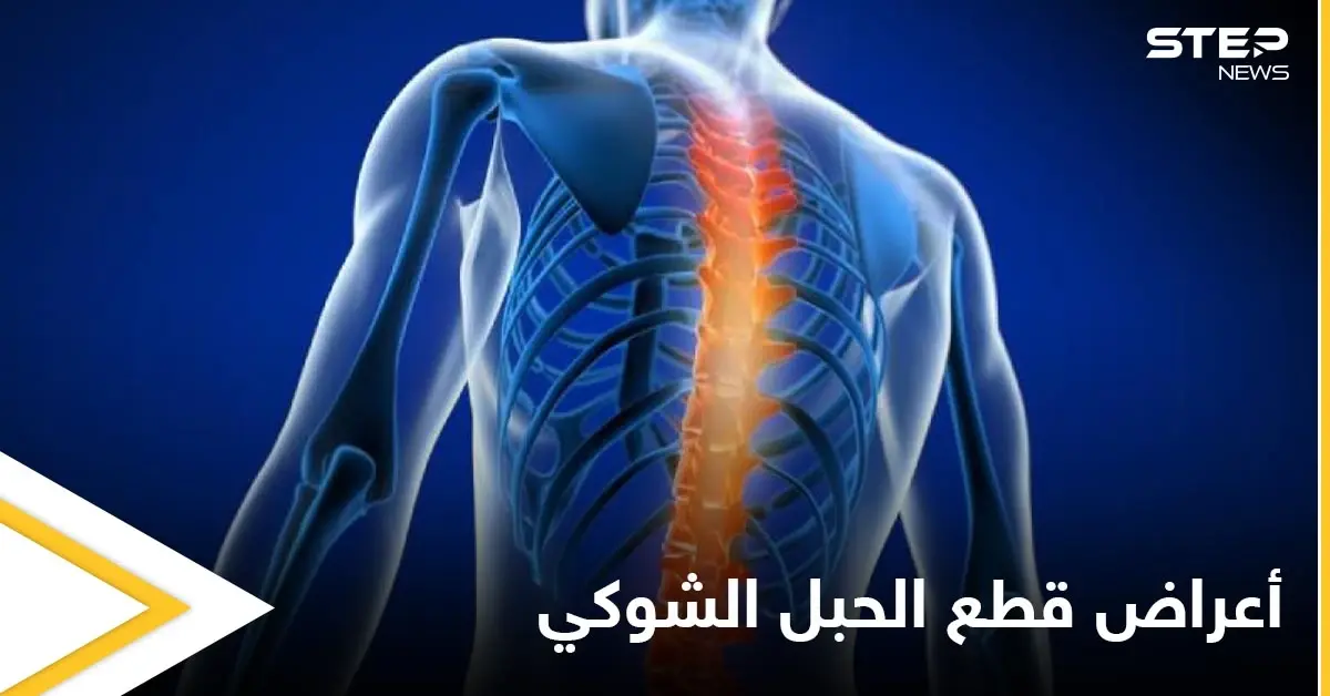 تعرف على أنواع وأعراض قطع الحبل الشوكي وطرق العلاج: قطع الحبل الشوكي