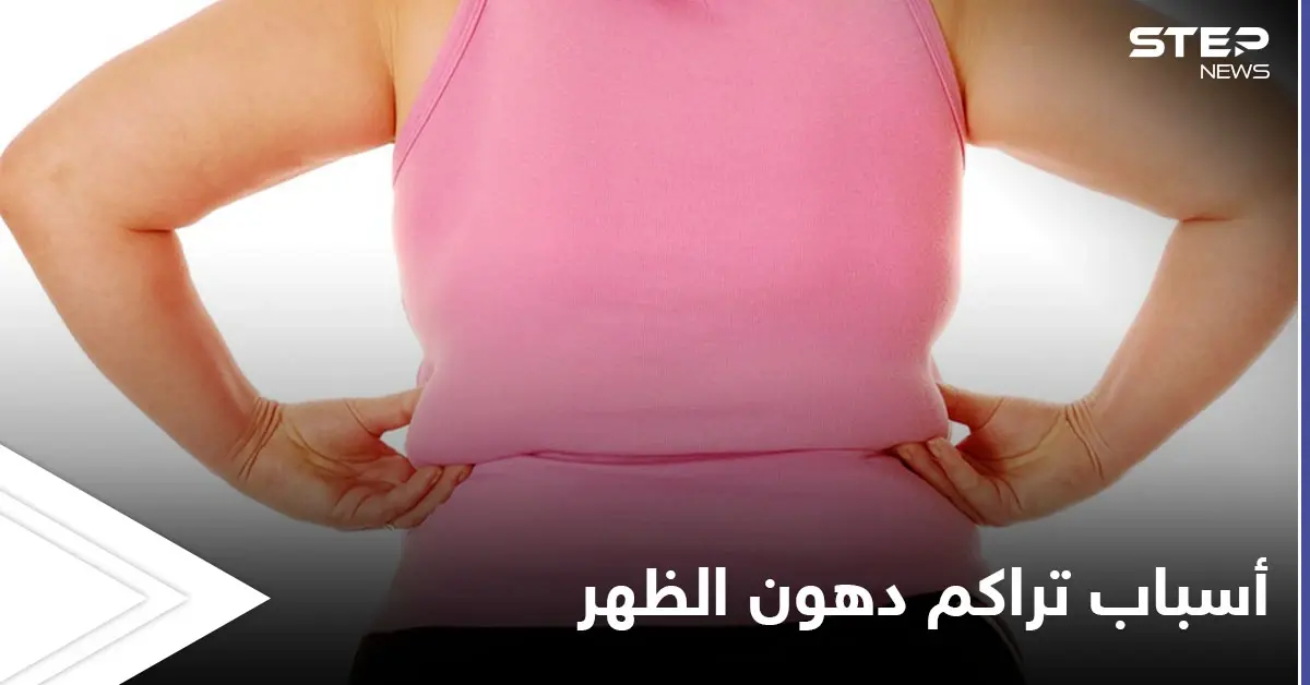 تعرف على أسباب تراكم دهون الظهر وطرق بسيطة للتخلص منها: دهون الظهر