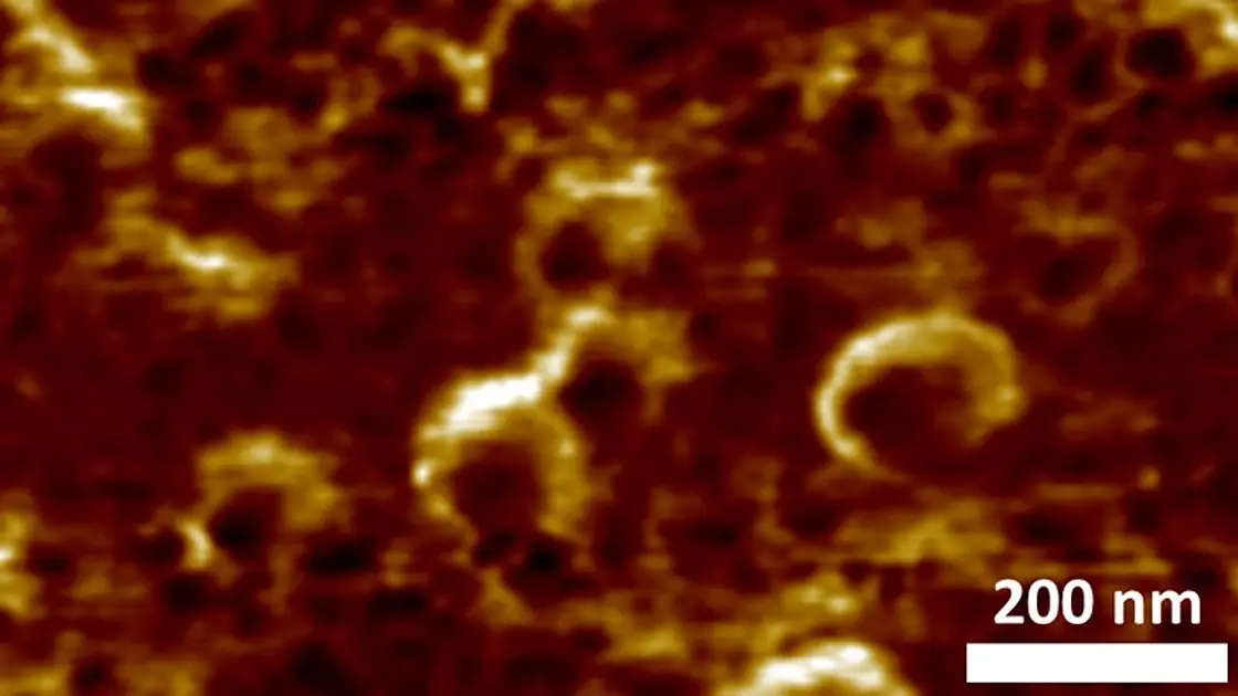 بالصور|| أصغر من الشعرة بـ750 مرة.. جامعة تركية تكشف تصويراً ثلاثي الأبعاد لفيروس كورونا: شرق تركيا