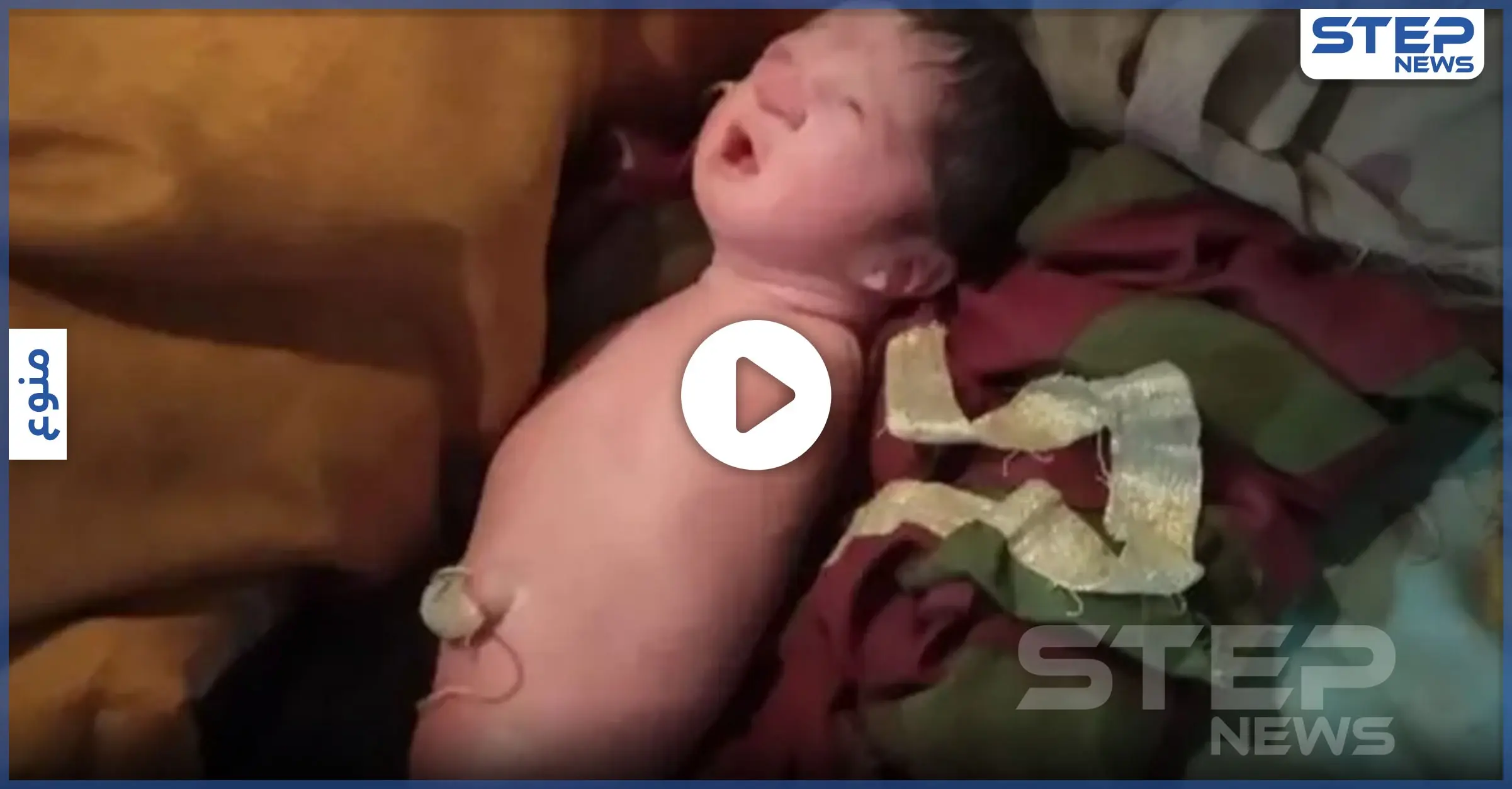 بالفيديو|| بـ حالة طبية نادرة جداً.. طفلة تولد بدون أطراف: الهند