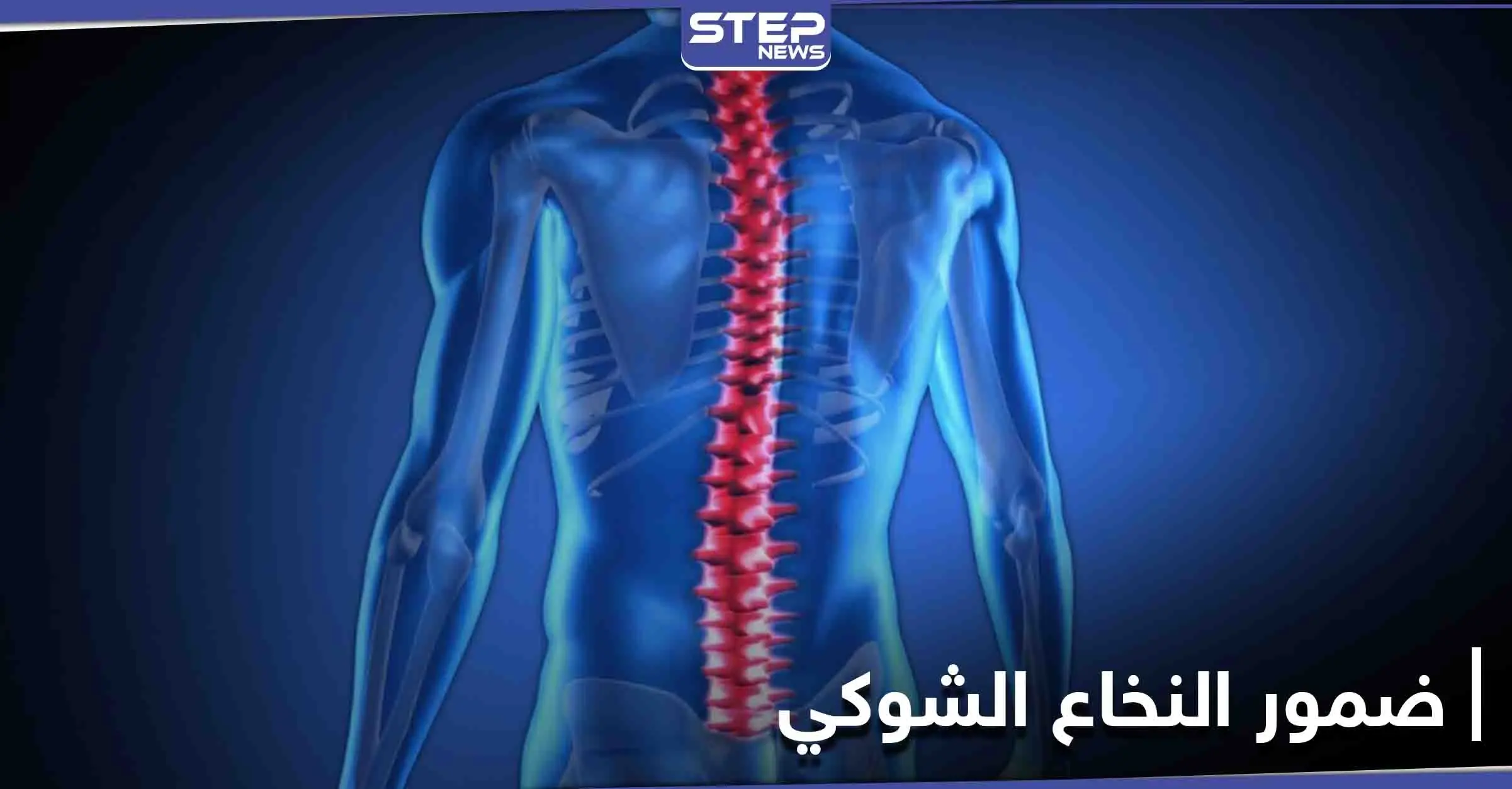 تعرف على مرض ضمور النخاع الشوكي أسبابه ومراحل خطورته على حياة الإنسان: ضمور النخاع الشوكي