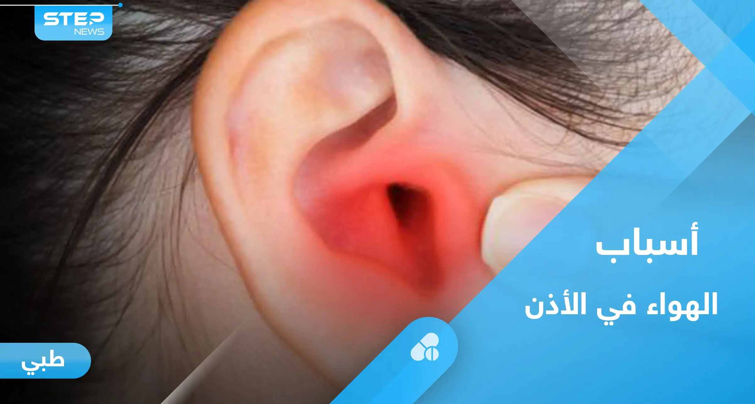 هل شعرت يوماً بـ "هواء في الأذن".. إليك الأسباب وطرق العلاج: الجيوب الأنفية