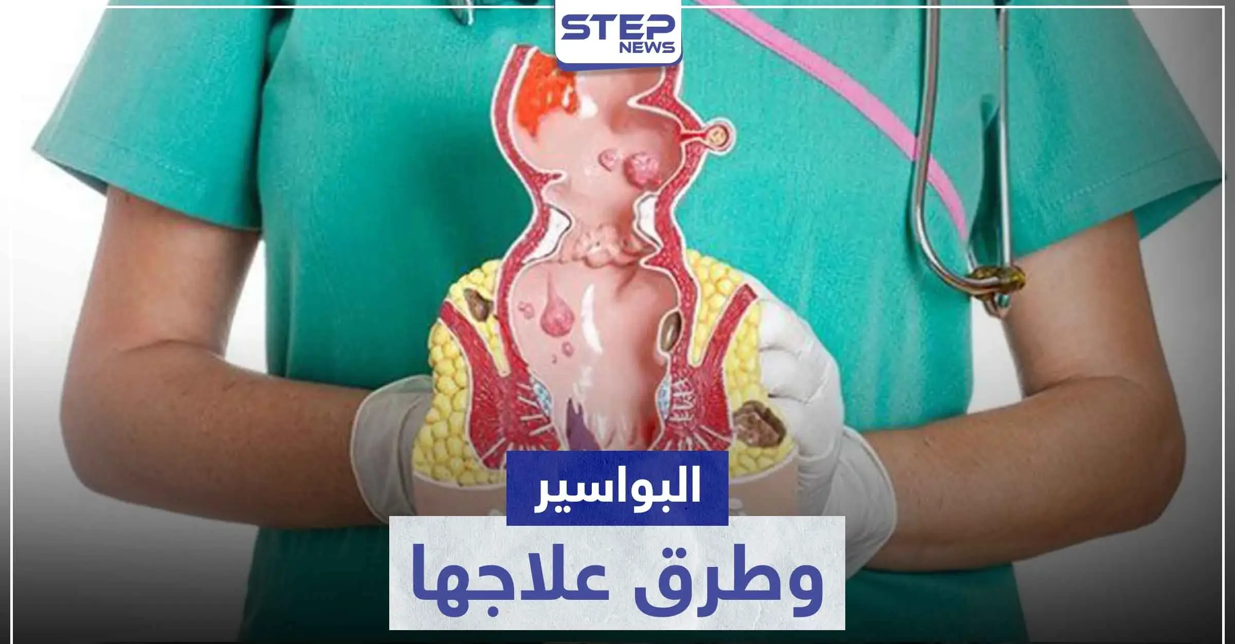 أفضل علاج للبواسير في المنزل و الصيدليات: إرشادات عامة