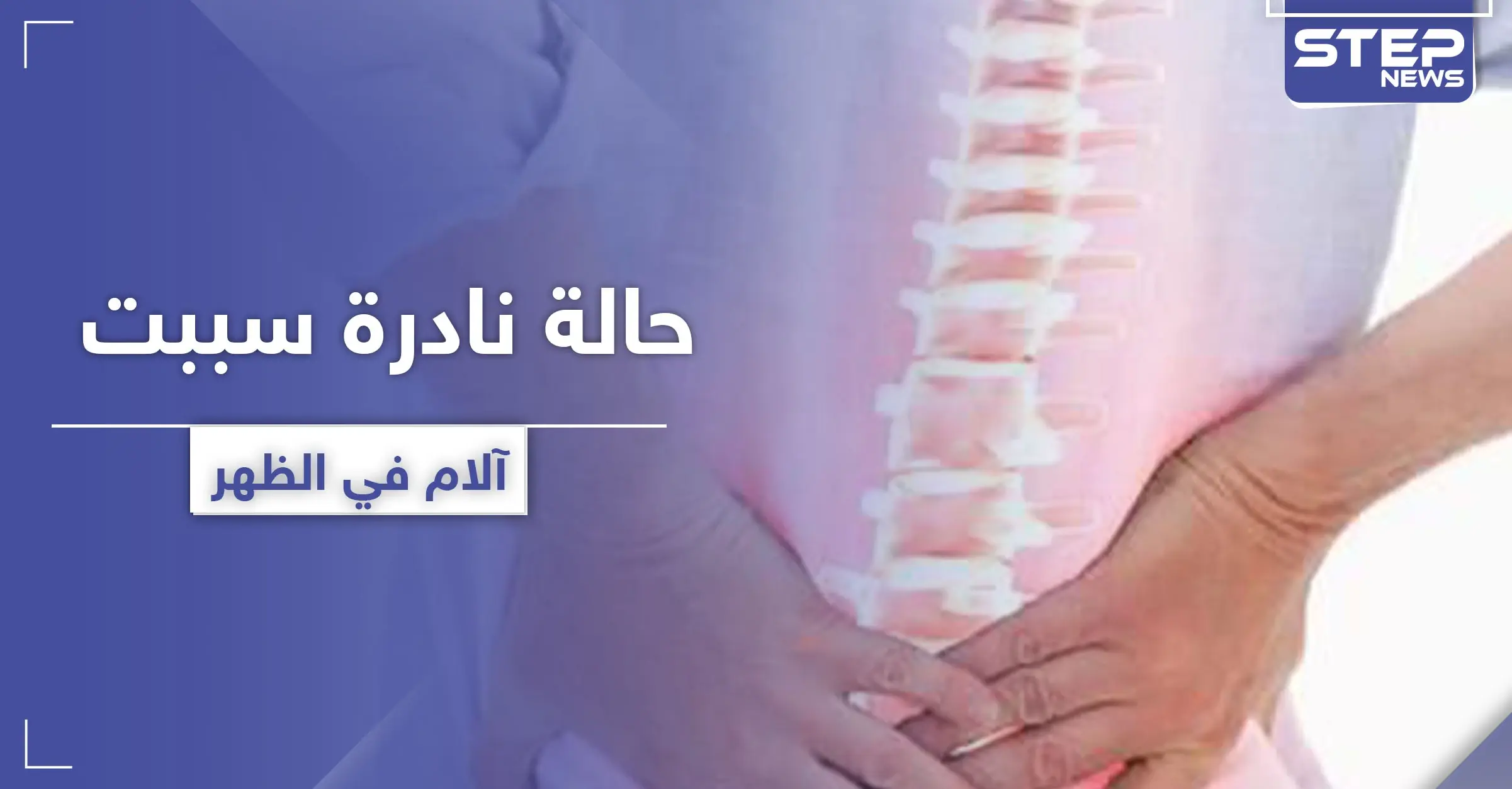 سببت آلام في الظهر.. حالة نادرة لرجل تدهش الأطباء: آلام الظهر