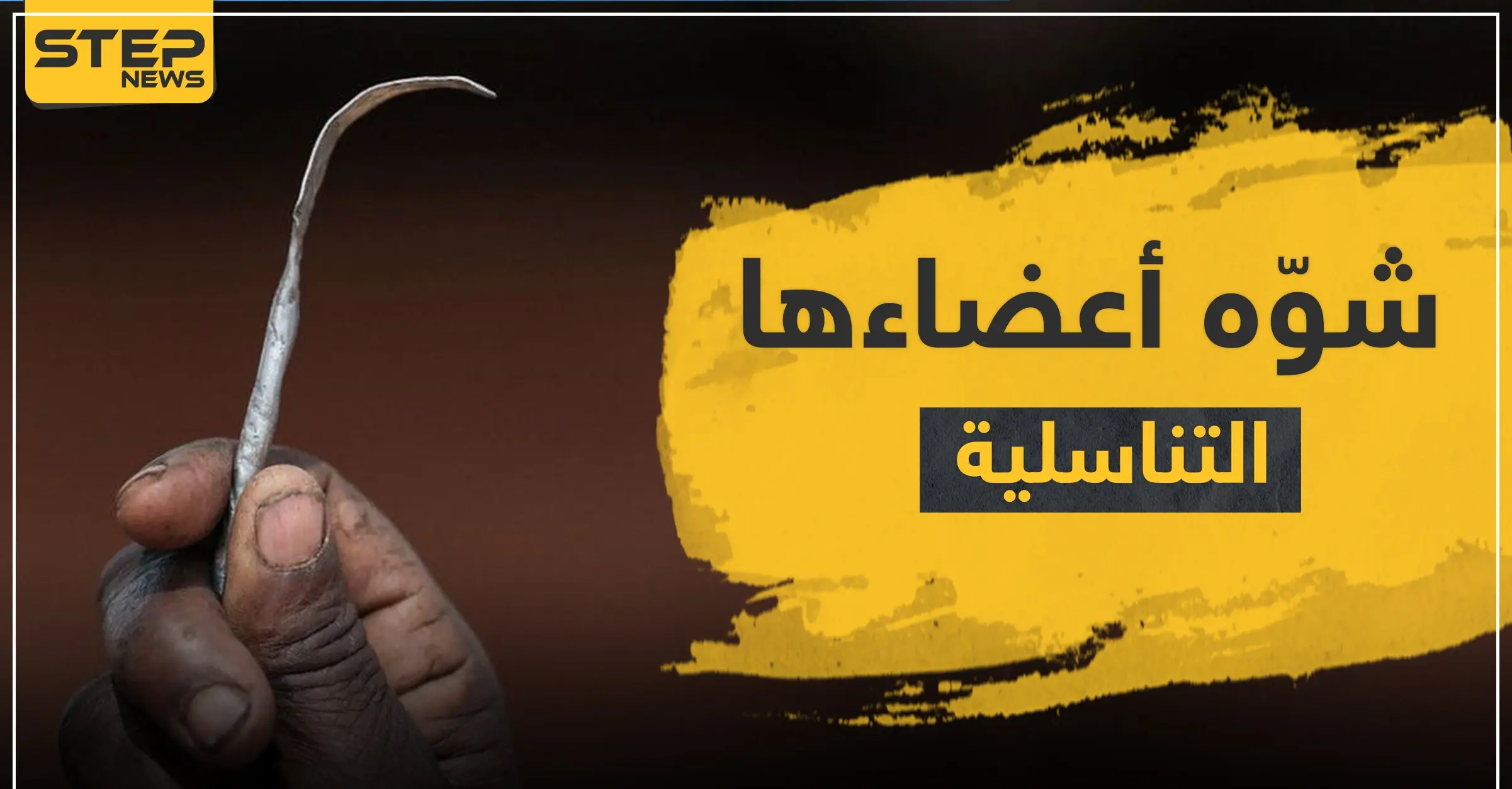 شوه أعضاءها التناسلية بعملية ختان.. طبيب مصري أمام المحكمة: طفلة