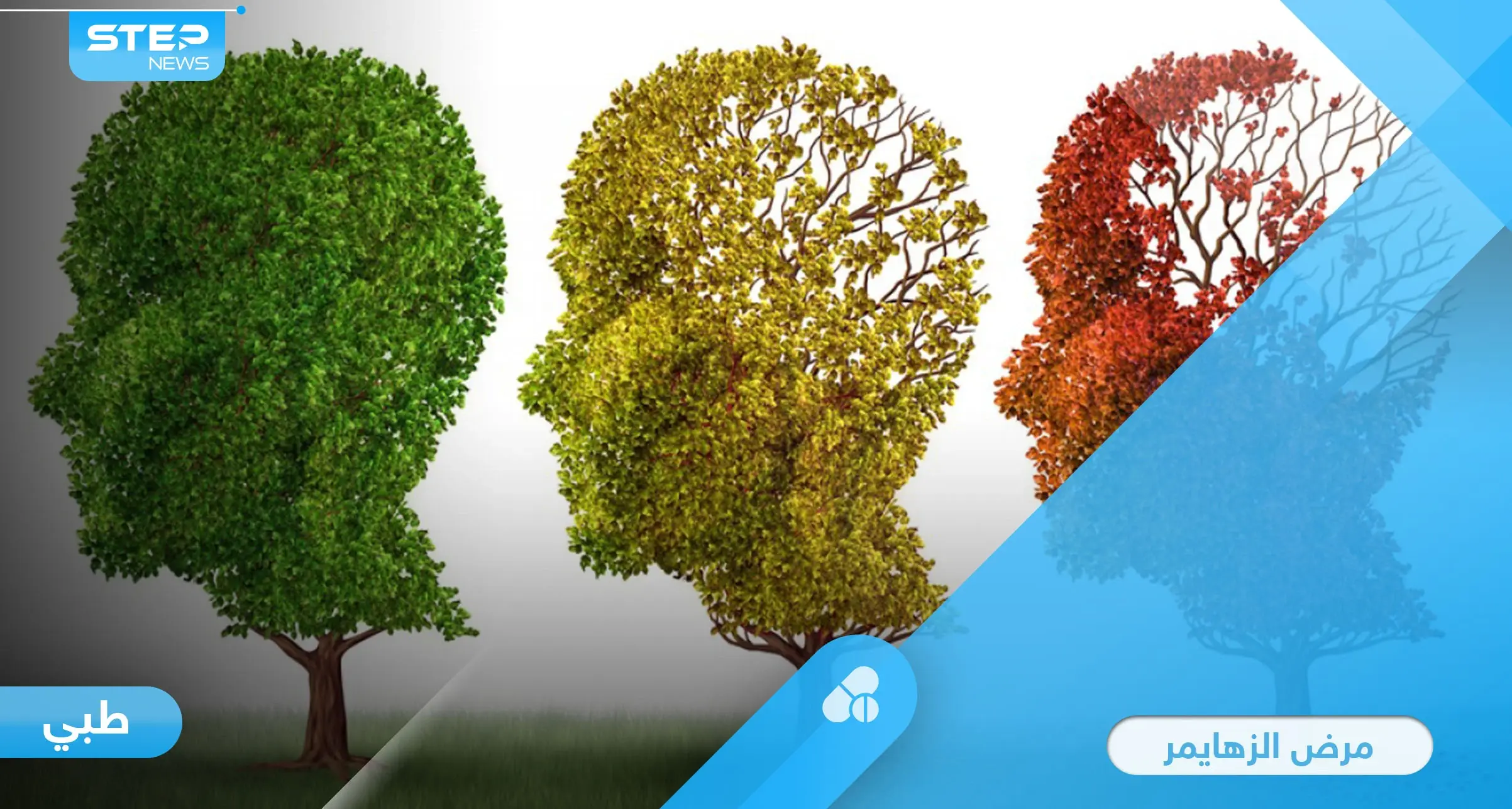 اكتشاف ثوري حول مرض الزهايمر.. نقل دم الرياضيين إلى المرضى يساهم في العلاج: الرياضة