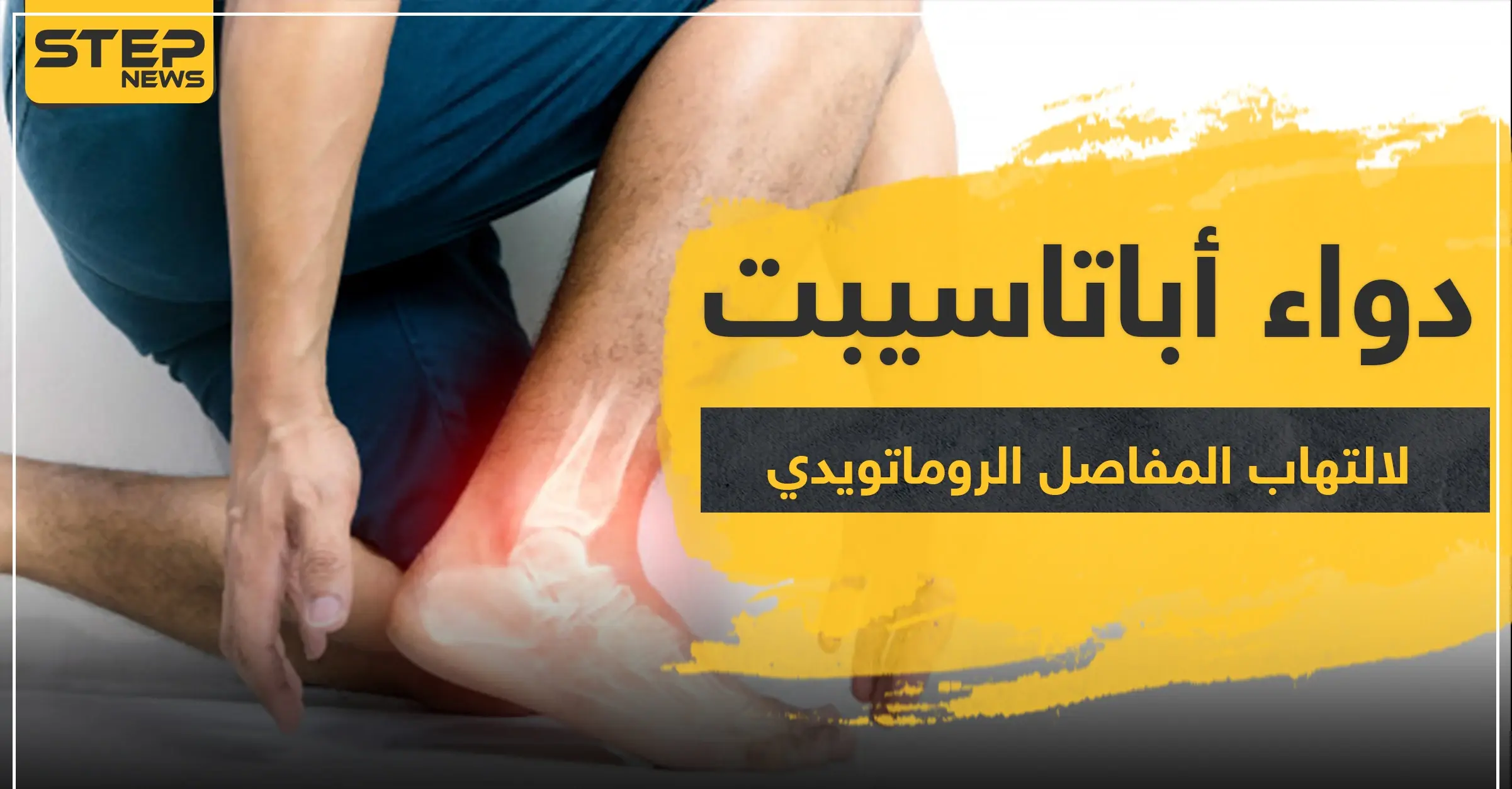 دواء أباتاسيبت لالتهاب المفاصل الروماتويدي: التهاب المفاصل