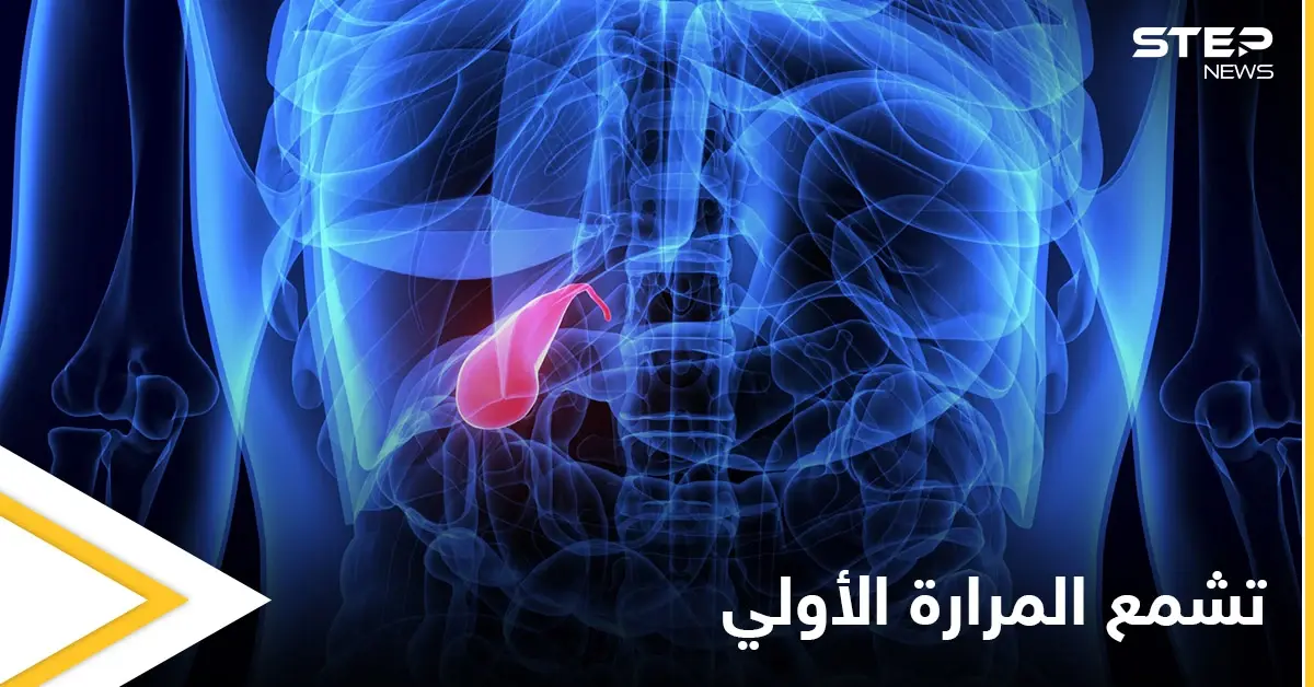 من أخطر الأمراض تشمع المرارة الأولي أسبابه وأعراضه وأهم المعلومات عنه: المرارة