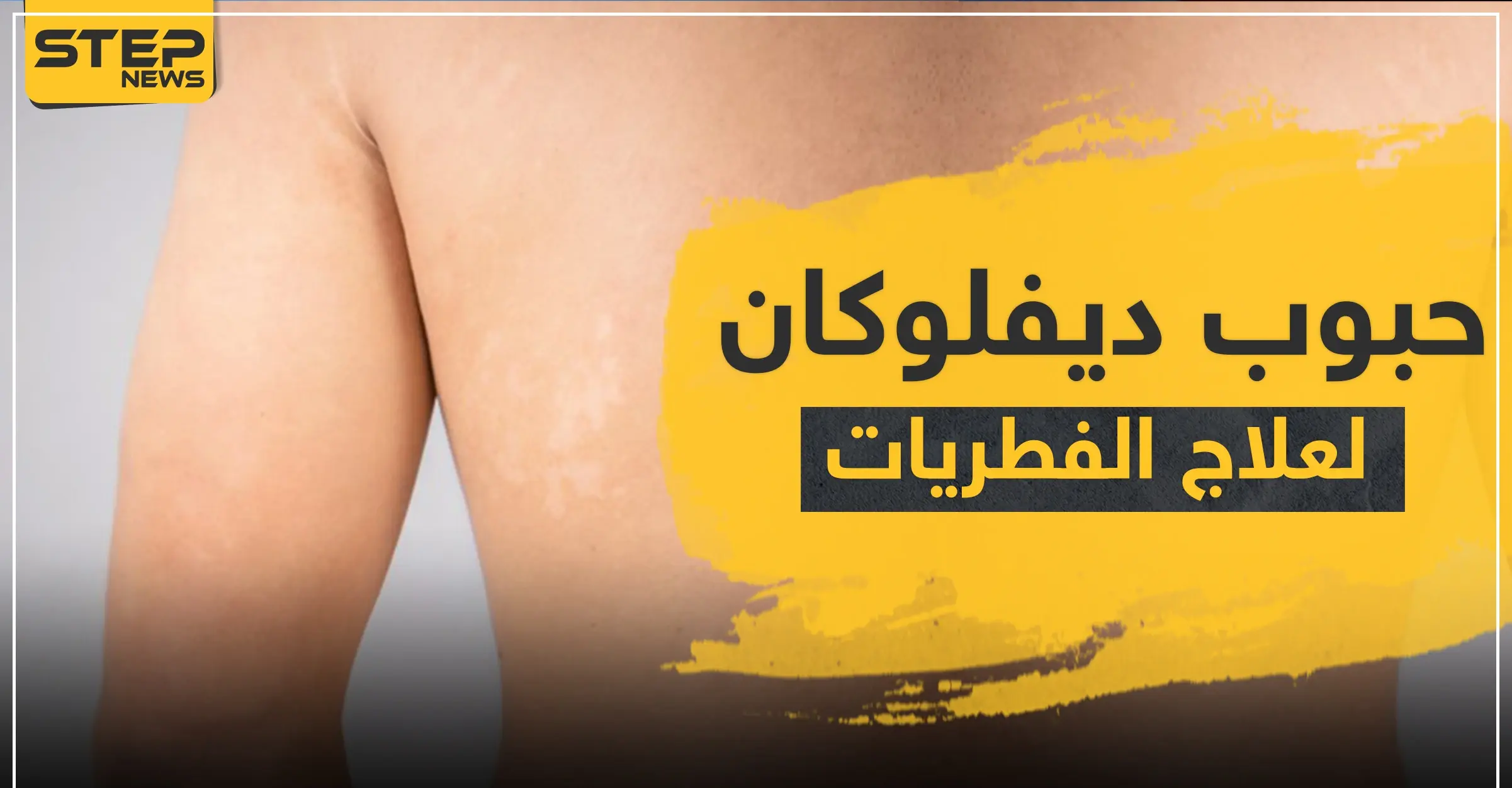 حبوب ديفلوكان لعلاج الفطريات: الفطريات