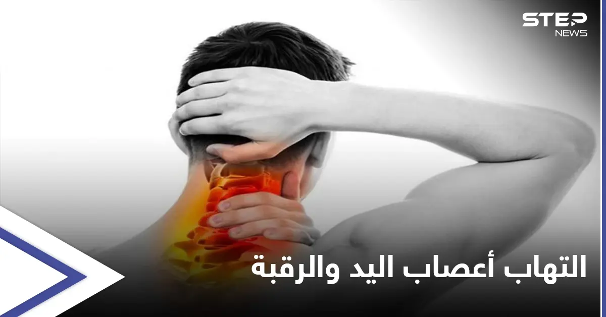 ما هو التهاب أعصاب اليد والرقبة وأفضل طرق العلاج إليك أهم المعلومات: الصحة
