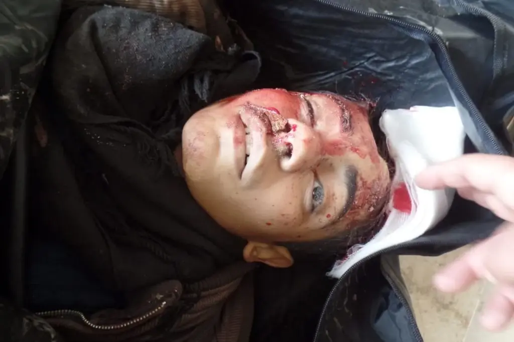 النظام يرتكب مجزرة بـ معرة النعمان مستهدفًا أسواق المدينة: مجزرة