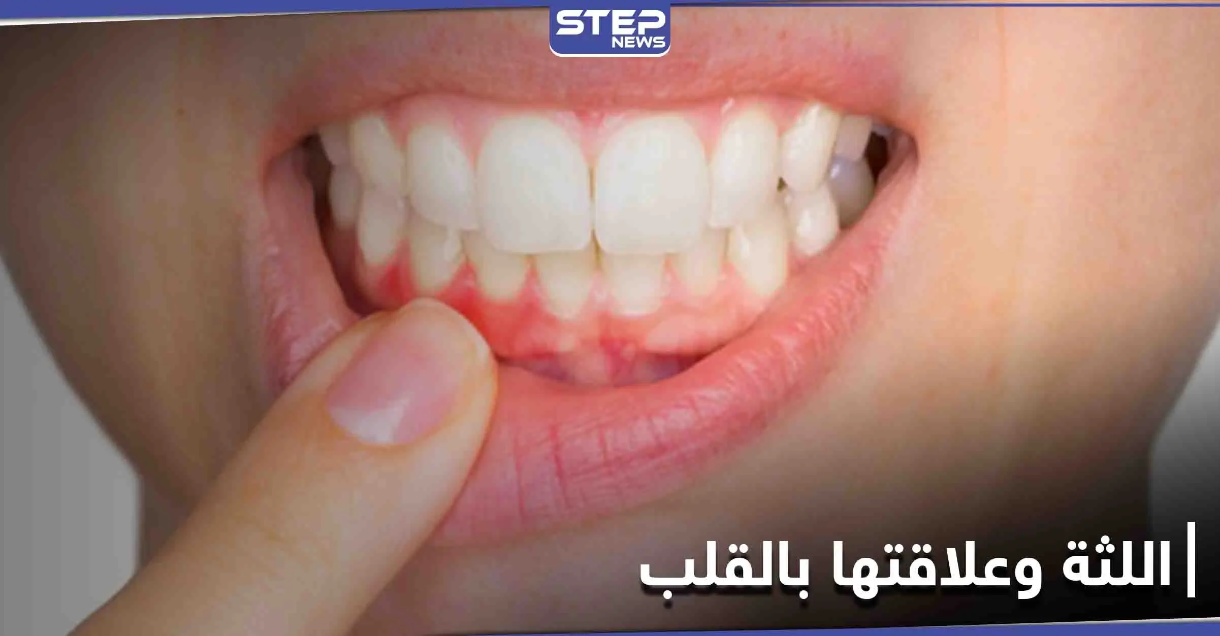 علامات تحذيرية غير معروفة موجودة في الفم قد تكشف أمراض القلب مبكراً: القلب