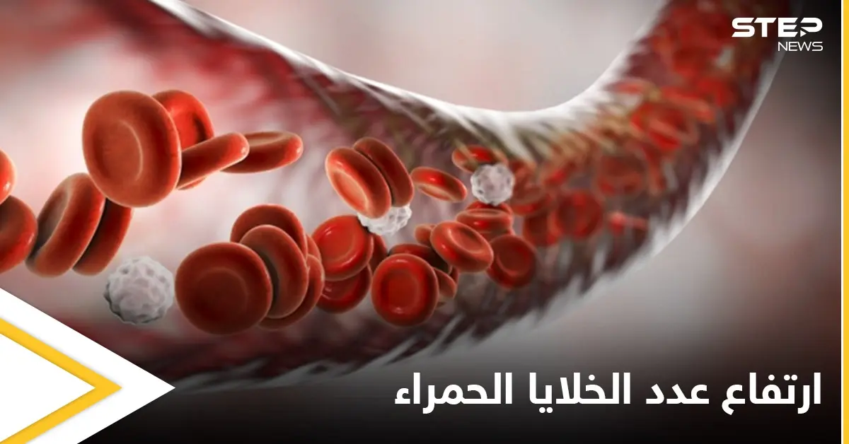 أسباب ارتفاع عدد خلايا الدم الحمراء والمشاكل الصحية المرتبطة بها: أسباب