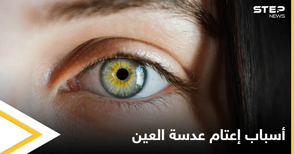 التدخين أحد أسبابه.. إعتام عدسة العين وخطورته وأبرز المسببات لحدوثه إليك اهم المعلومات: أسباب