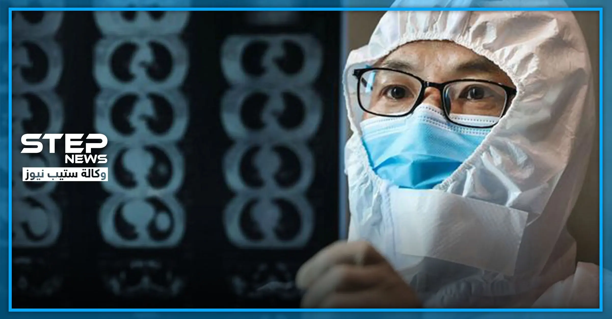 شاهد|| كيف أصبحت بشرتهما سوداء.. حالة غريبة تصيب طبيبين مصابين بكورونا في مستشفى ووهان: صور العالم