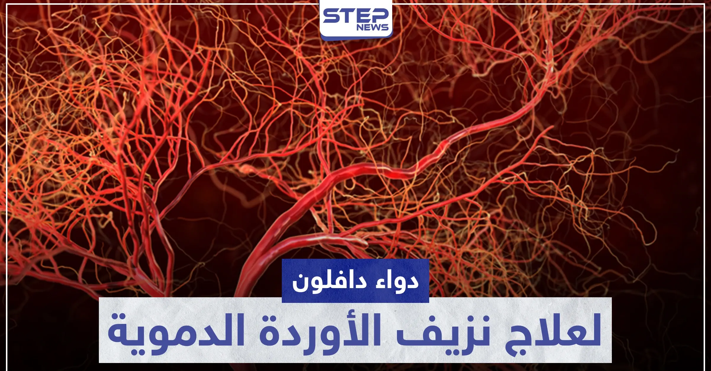 دواء دافلون Daflon لعلاج نزيف الأوردة الدموية: إرشادات عامة