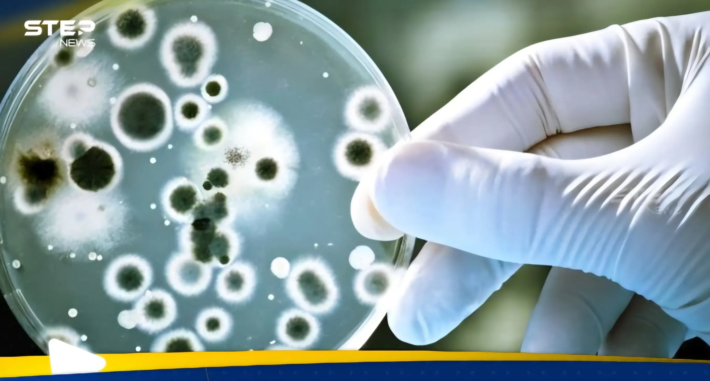 دراسة عربية تحذر من بكتيريا خطيرة في المنتجات البحرية: منوع