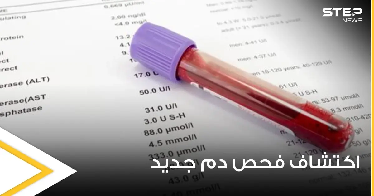 في اختراق عملي مذهل.. التوصل لفحص دم بسيط يكشف 50 نوعاً من السرطان: السرطان