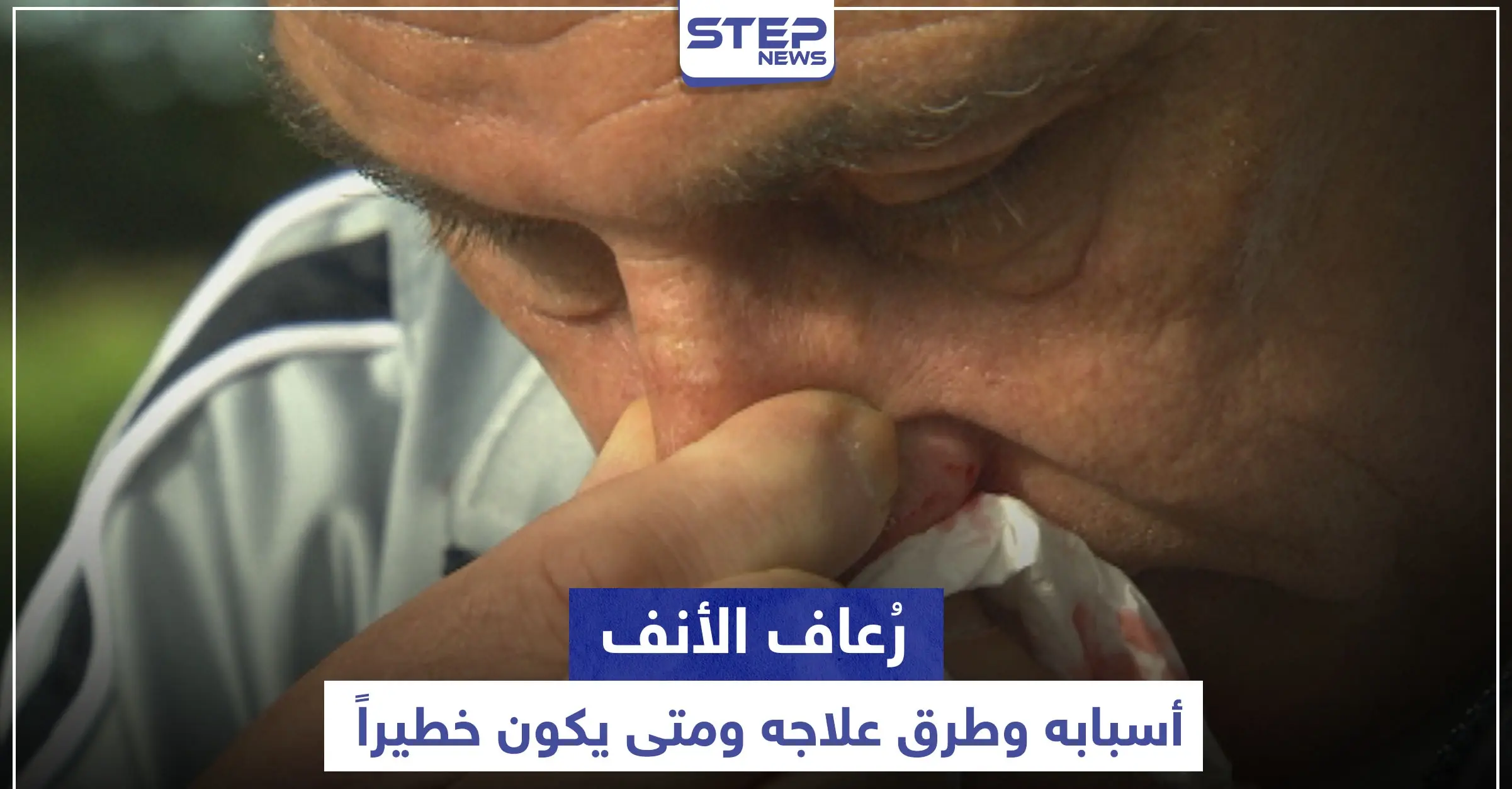 متى يكون رُعاف الأنف خطيراً .. أسبابه وطرق علاجه: الزكام