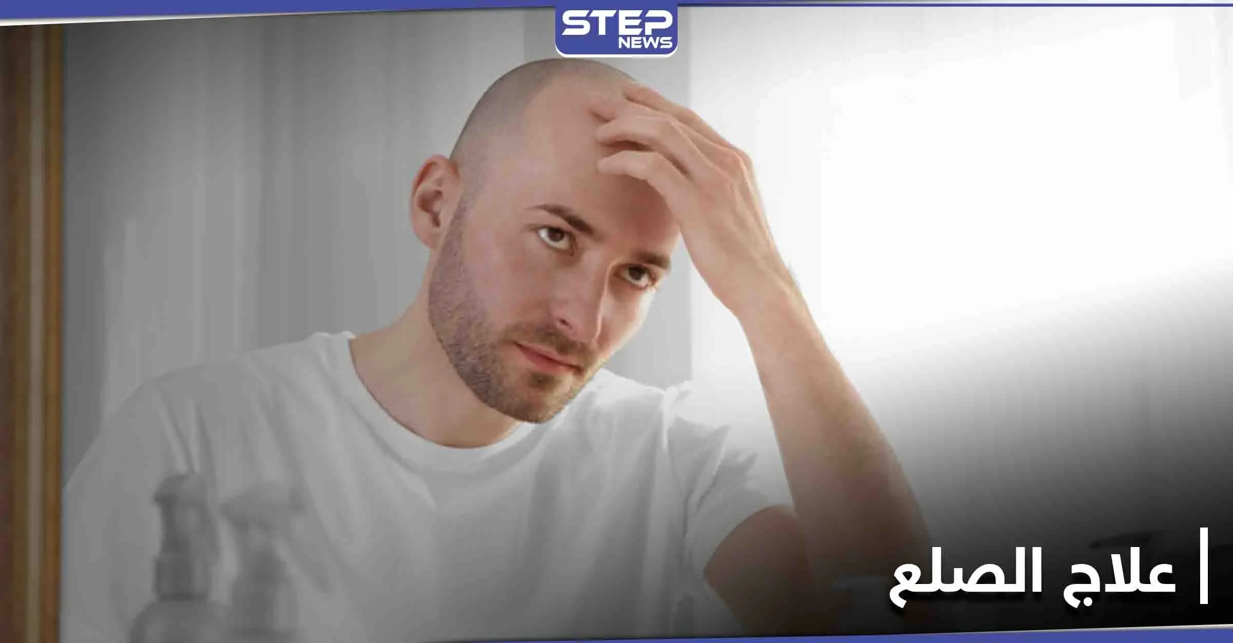 تمهيداً لعلاج الصلع.. العلماء يكشفون السبب الذي يثبّط نشاط بصيلات الشعر: تساقط الشعر