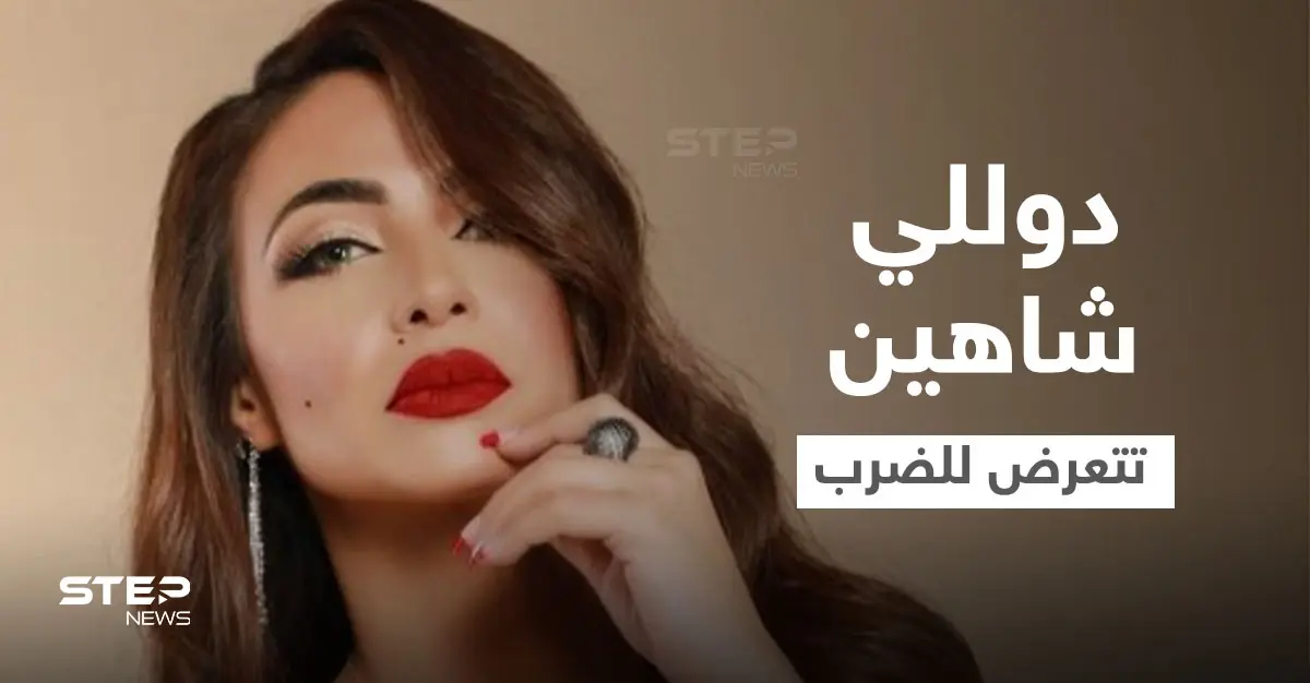 دوللي شاهين تتعرض للضرب المبرح وتنشر صور الكدمات التي ظهرت على وجهها وجسدها ومدير أعمالها يوضح (صور): إنستغرام