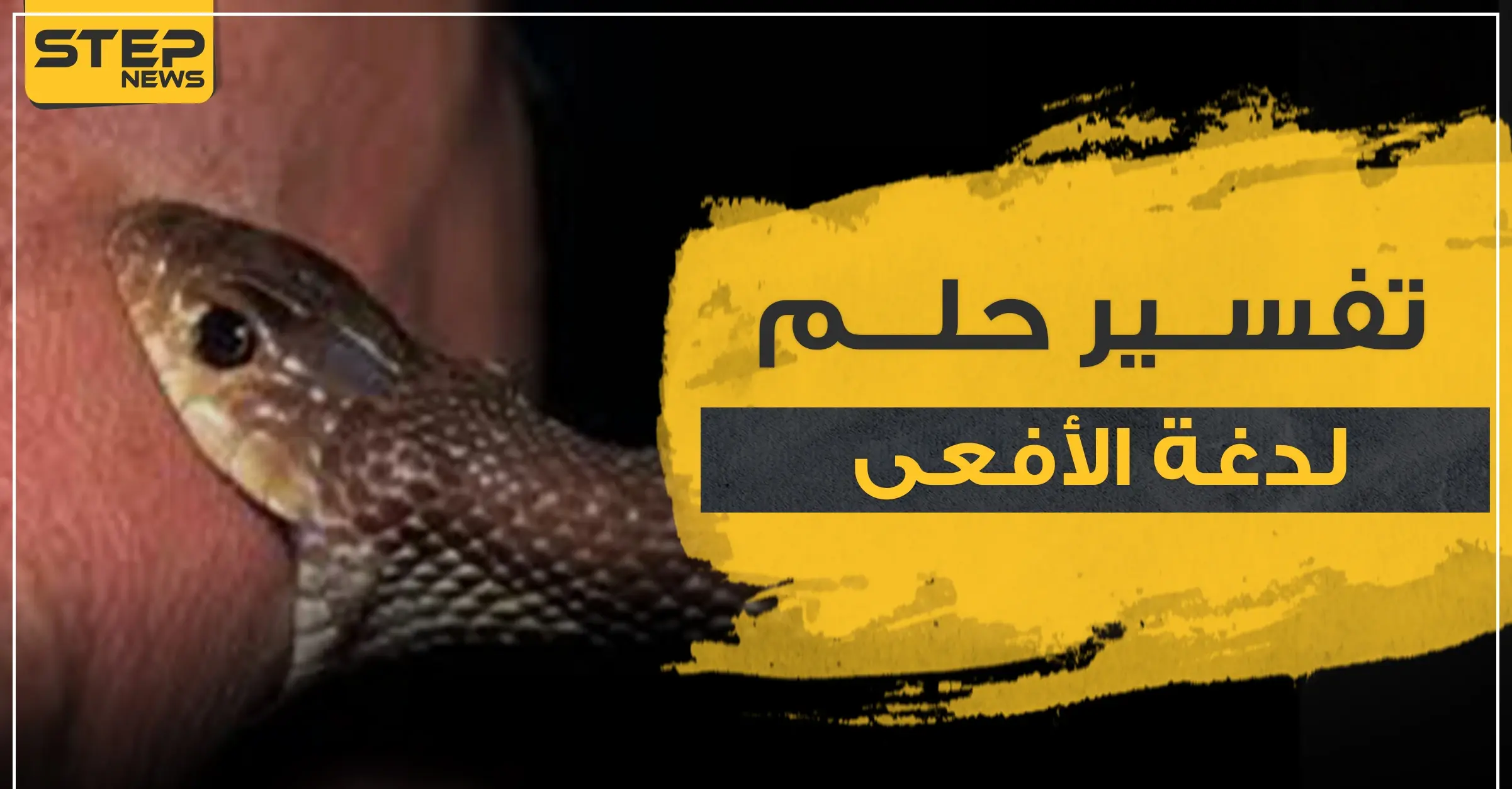 تفسير حلم لدغة الأفعى للفتاة العزباء.. وبحسب لون الأفعى ومكان اللدغة: تفسير الاحلام